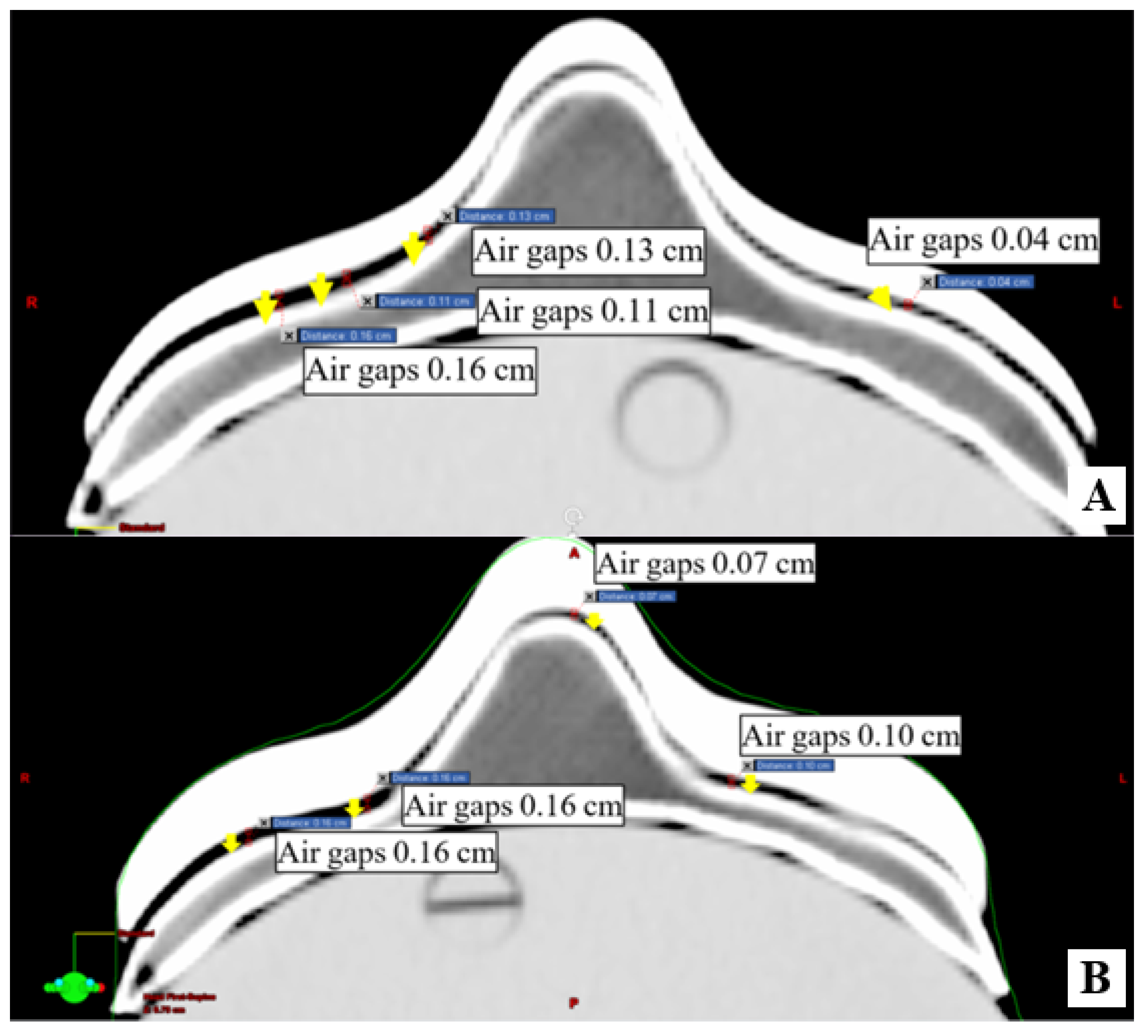 Applsci 11 08657 g006