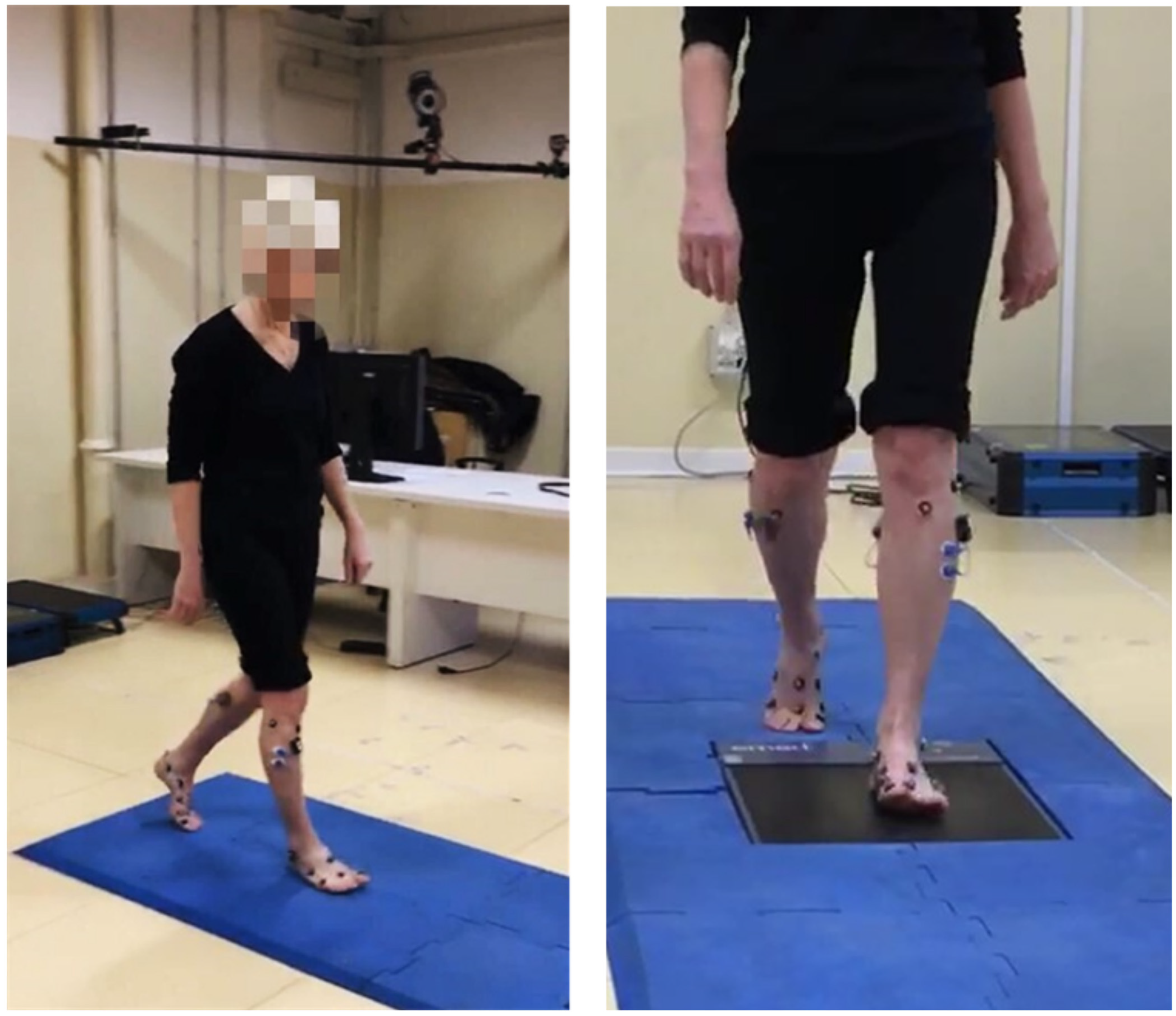Applied Sciences | Free Full-Text | The Effect of Neuropathy and Diabetes  Type on Multisegment Foot Kinematics: A Cohort Study on 70 Participants  with Diabetes