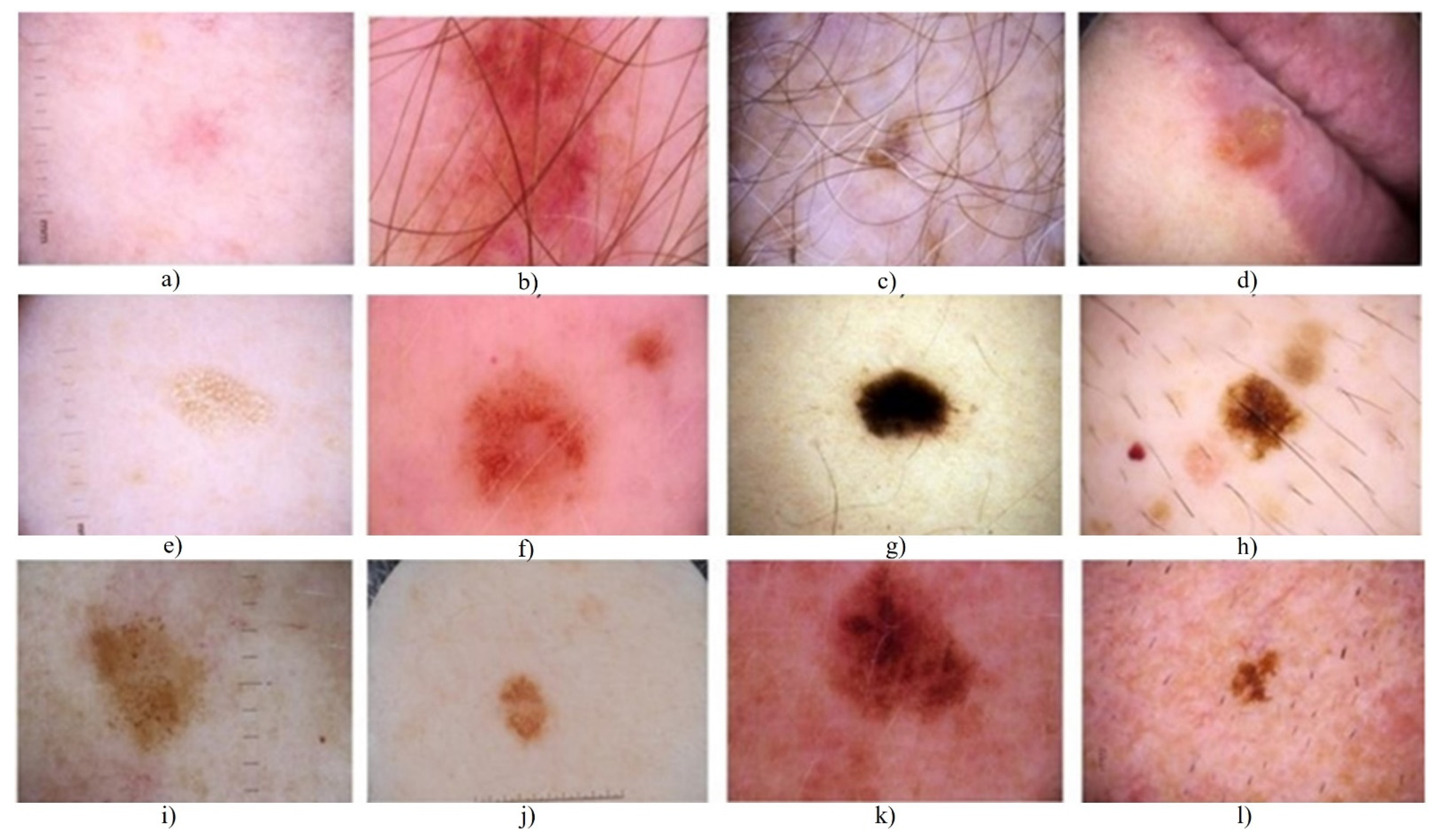Applied Sciences | Free Full-Text | A Reinforcement Learning Algorithm for  Automated Detection of Skin Lesions | HTML