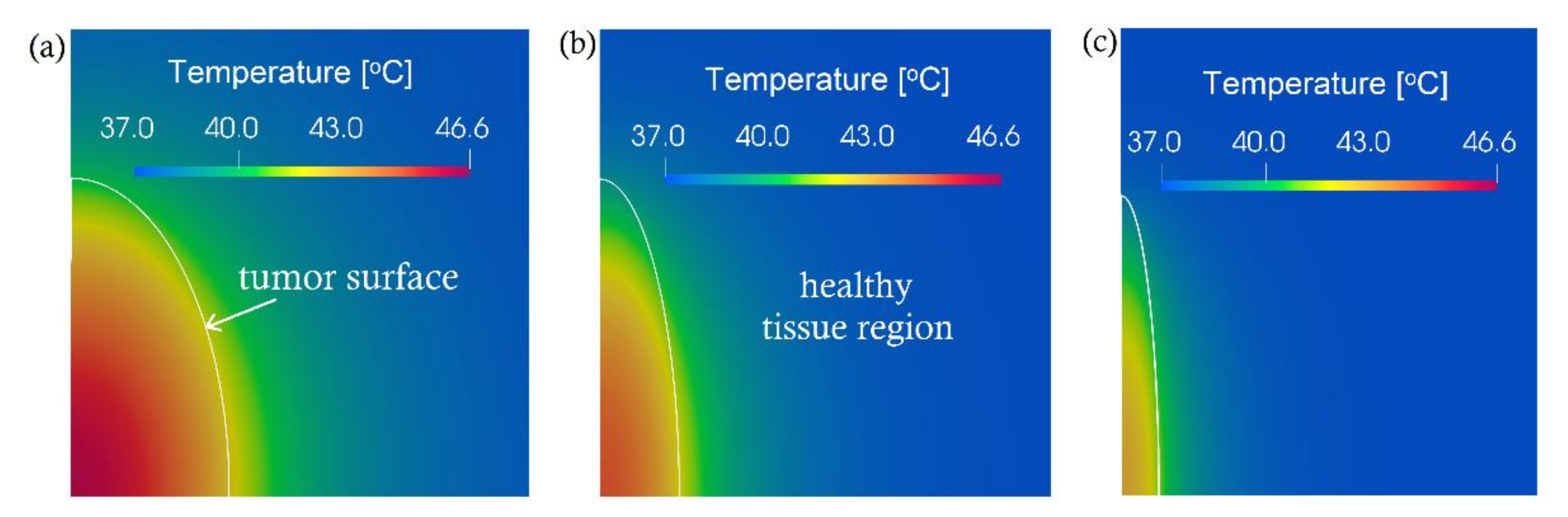 Applied Sciences Free Full Text A Computational Study On Magnetic Nanoparticles Hyperthermia Of Ellipsoidal Tumors Html