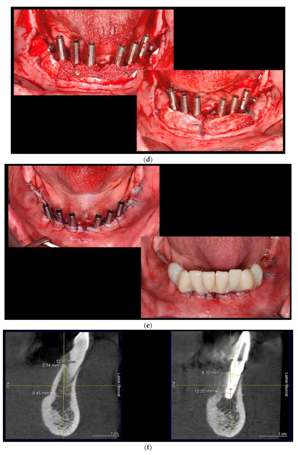 Applsci 11 09826 g001b