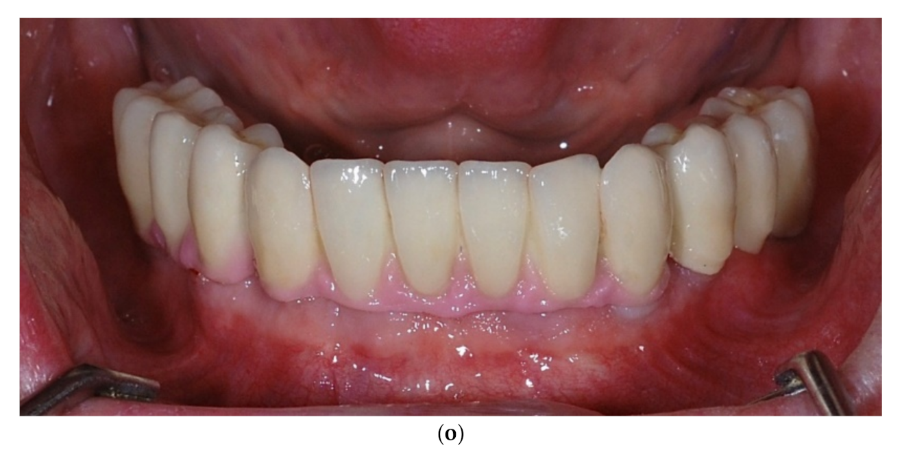 Applsci 11 09826 g001e