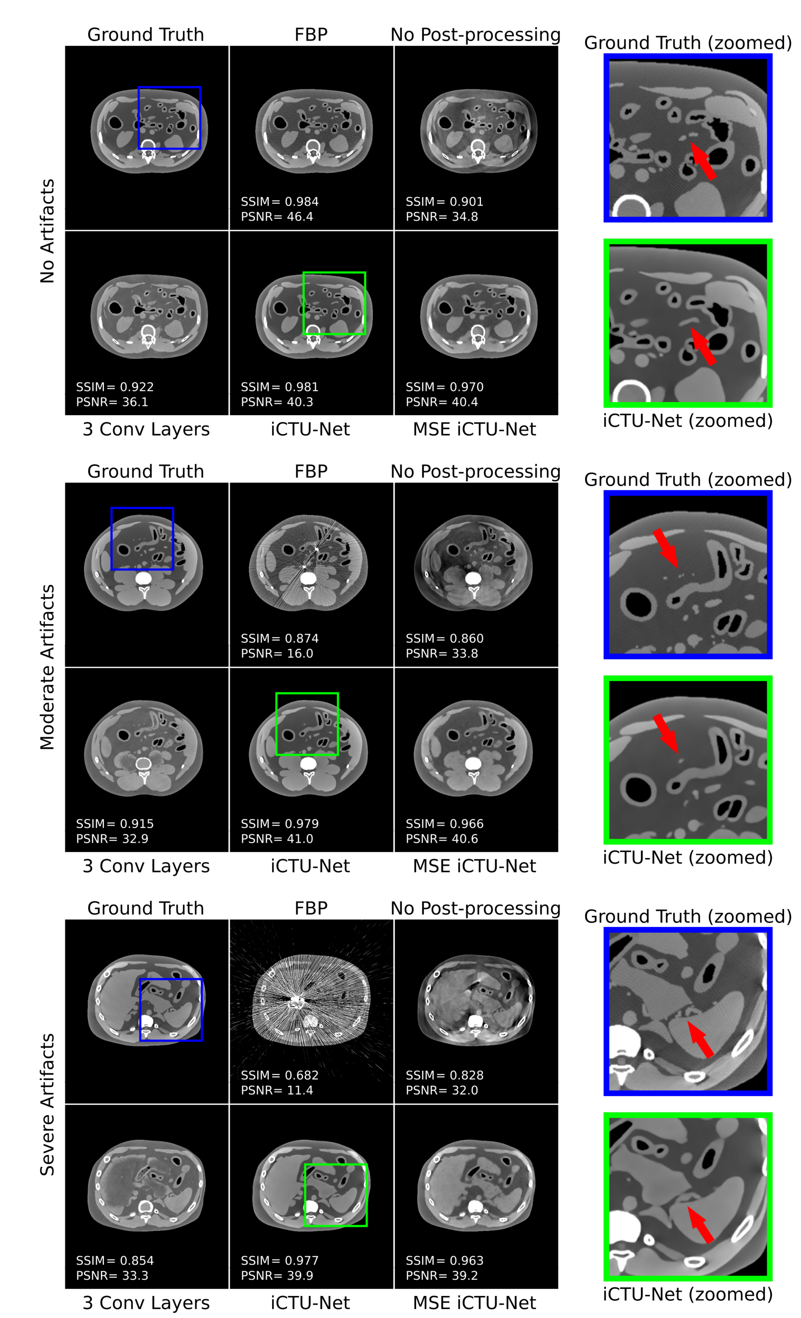 Applied Sciences Free Full Text End To End Deep Learning Ct Image Reconstruction For Metal Artifact Reduction