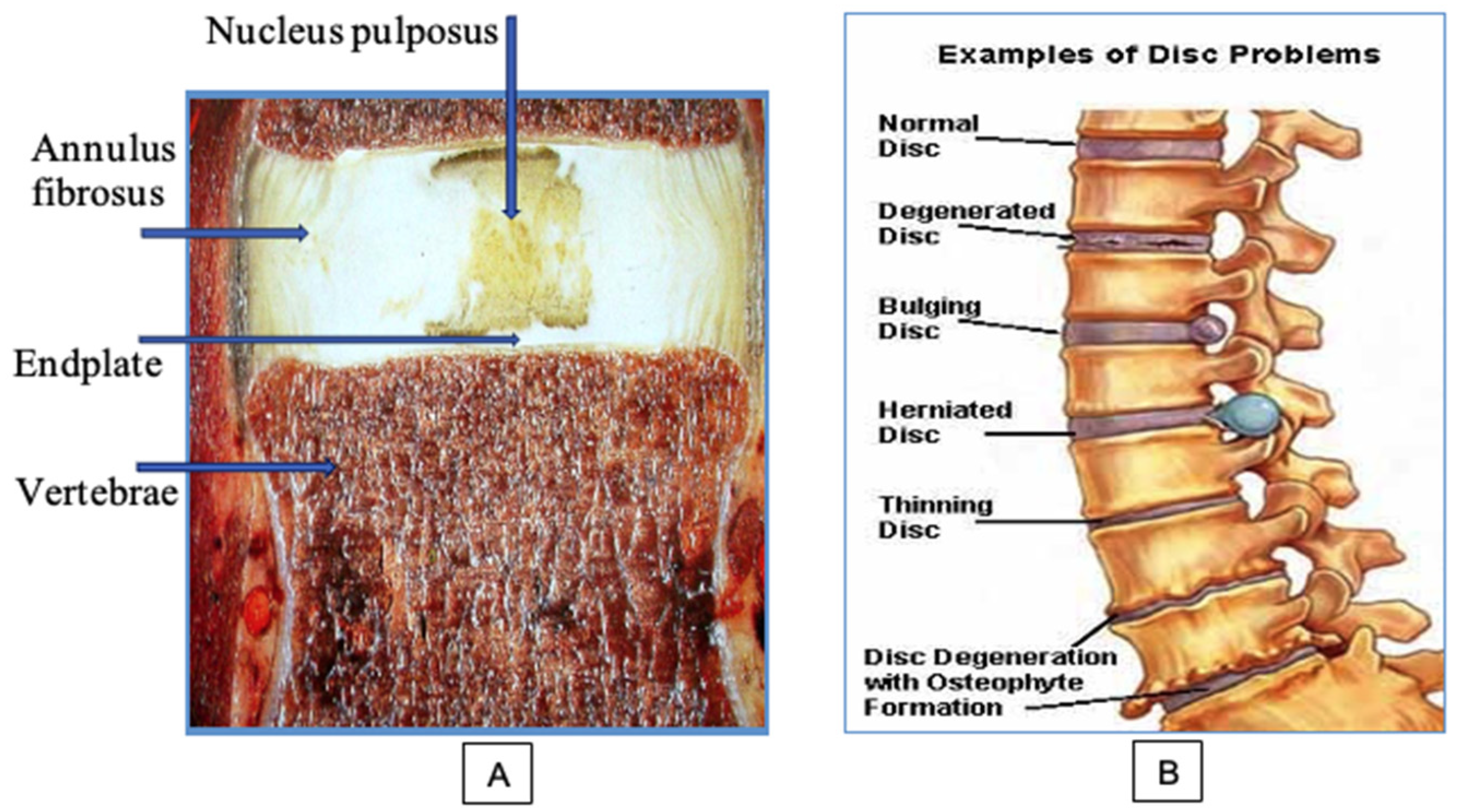 Applied Sciences | Free Full-Text | Laser Reconstruction of Spinal