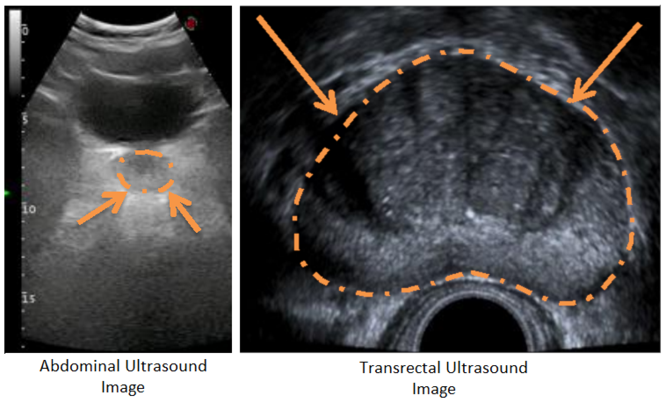 Applied Sciences | Free Full-Text | Estimation of the Prostate Volume from  Abdominal Ultrasound Images by Image-Patch Voting