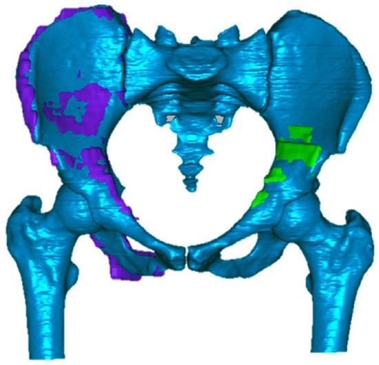 Three-dimensional model of the elements of the pelvic girdle (i.e.