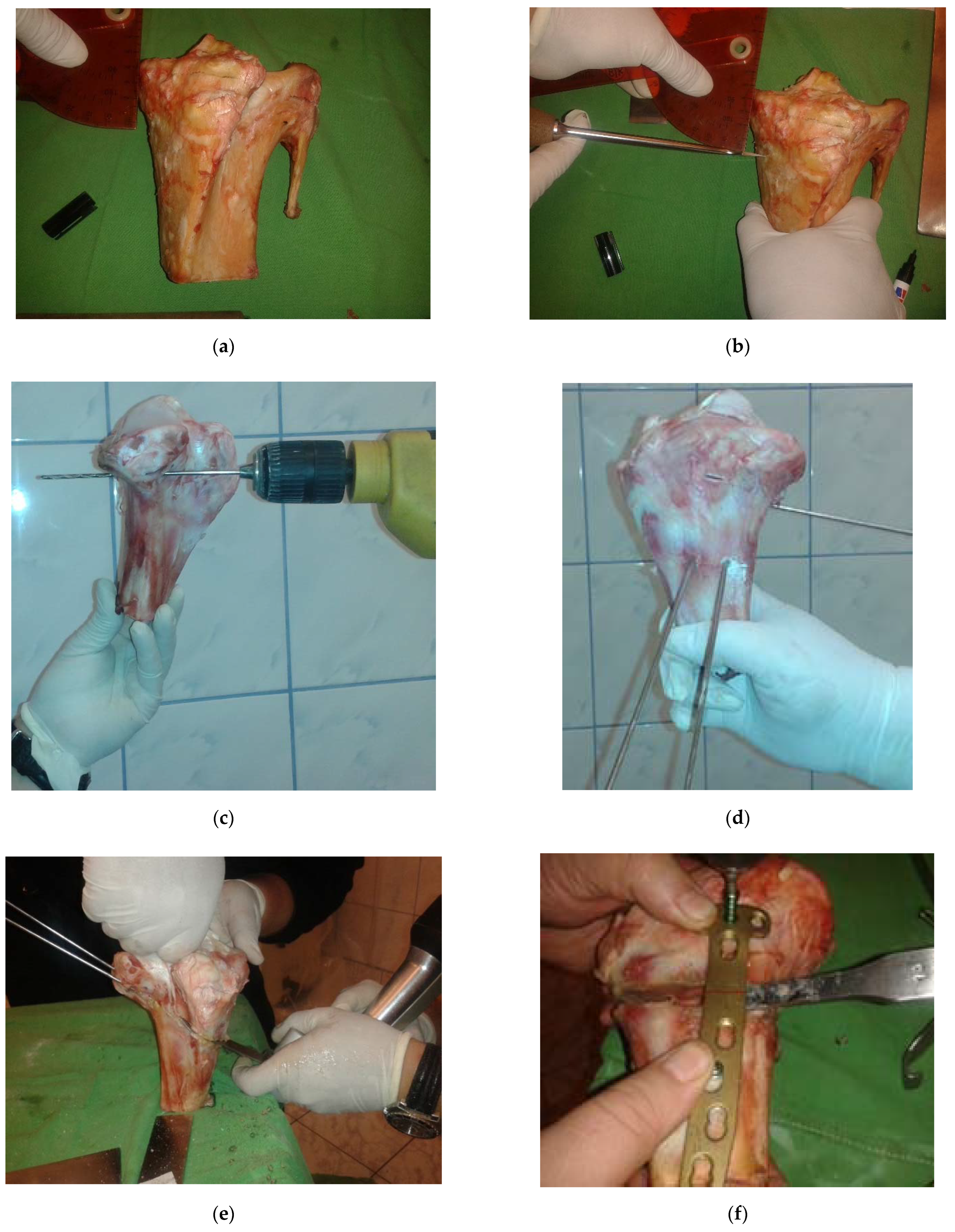 Applsci 12 02475 g002