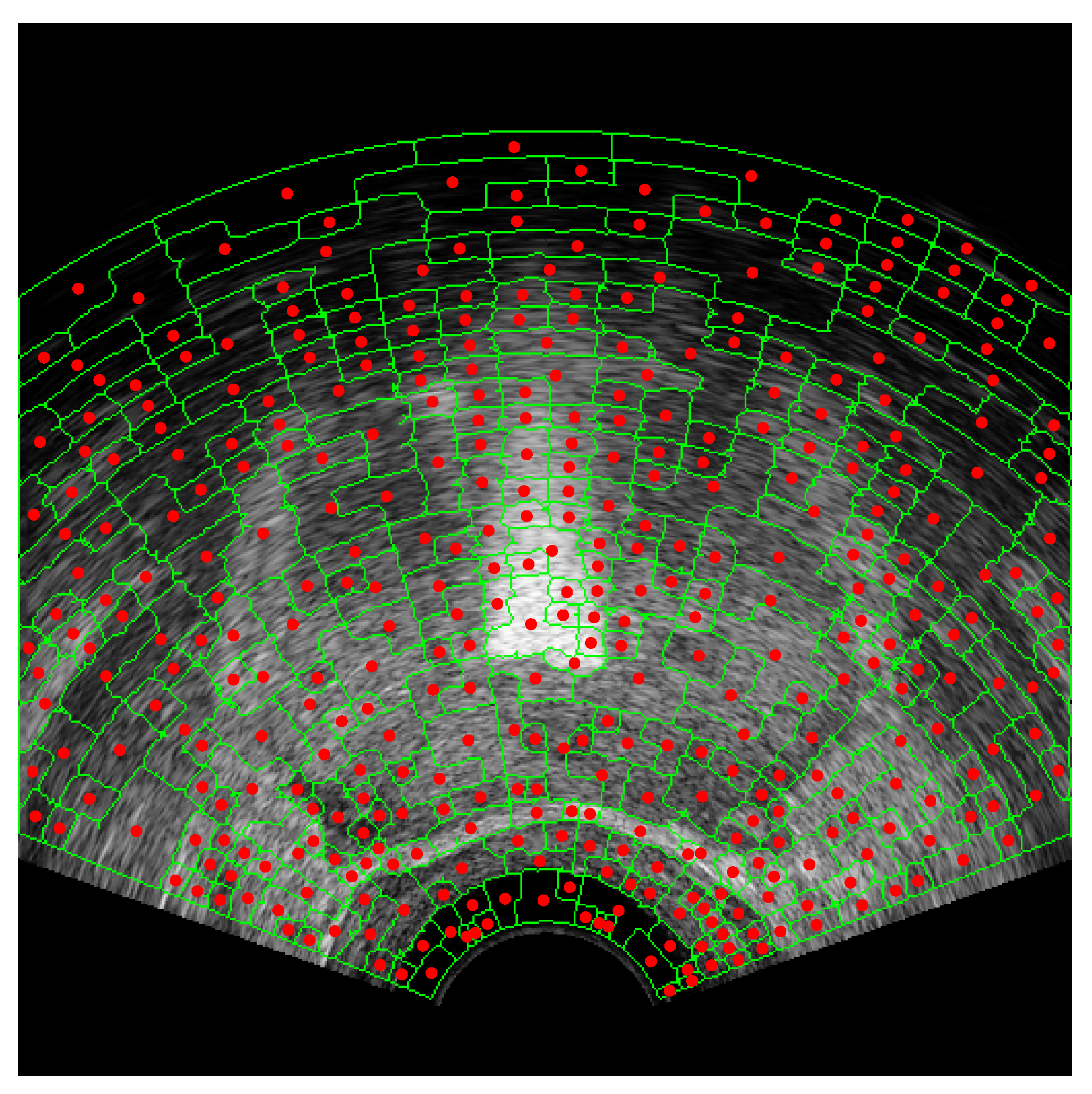 Applied Sciences | Free Full-Text | Autonomous Prostate Segmentation In ...