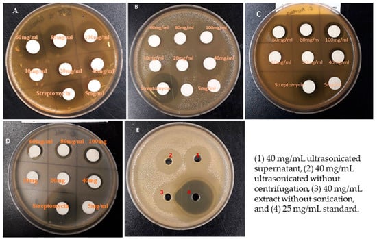 Applied Sciences | Free Full-Text | Antibacterial Activity of Nanoparticles  of Garlic (Allium sativum) Extract against Different Bacteria Such as  Streptococcus mutans and Poryphormonas gingivalis