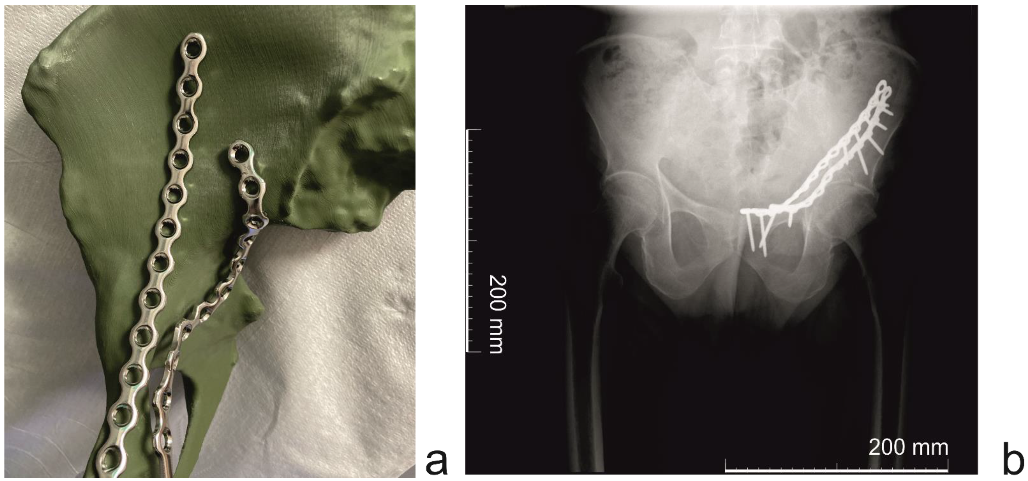 Applsci 12 03492 g005