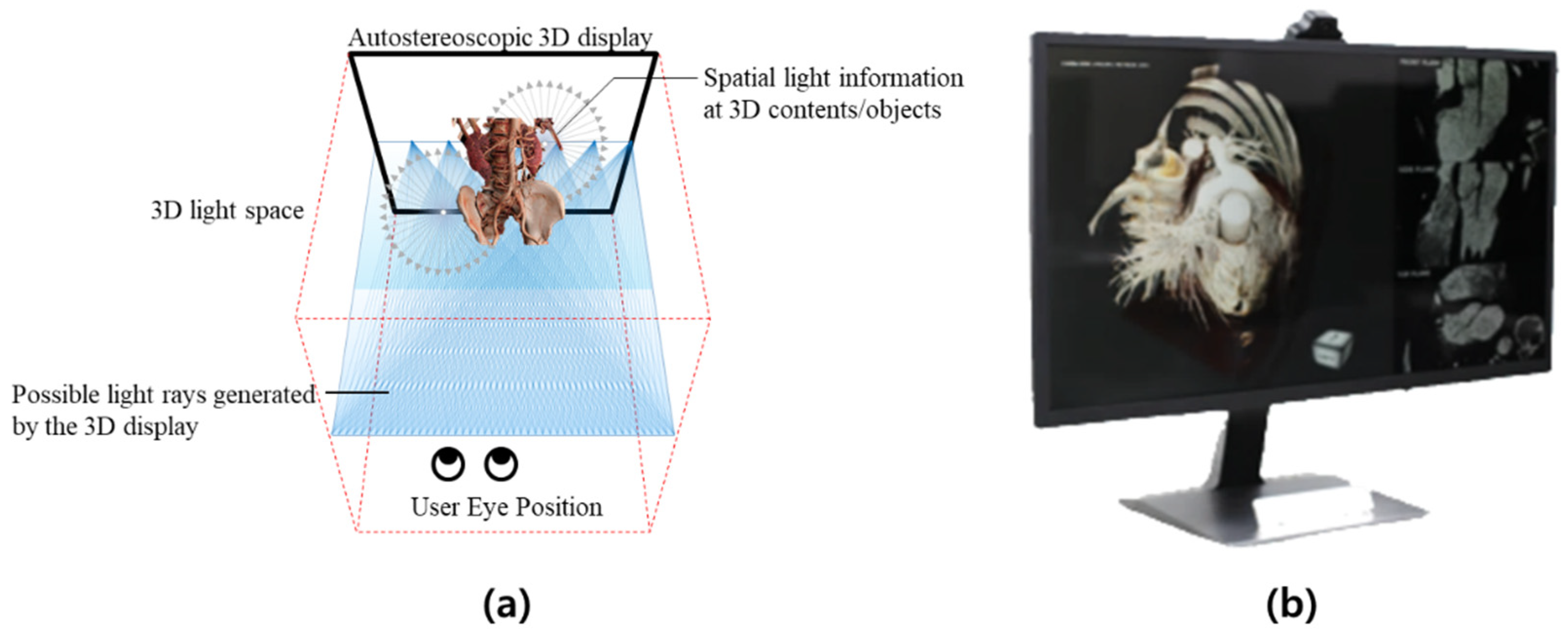 Applied Sciences | Free Full-Text | Autostereoscopic 3D Display System for  3D Medical Images