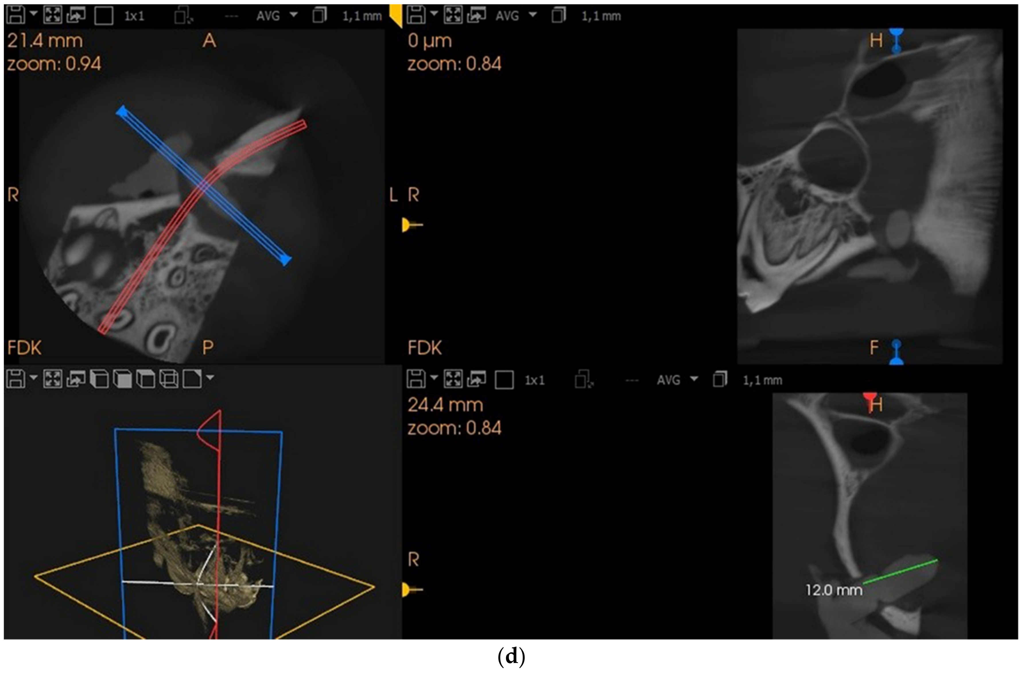 Applsci 12 04406 g001d Applsci 12 04406 g001d