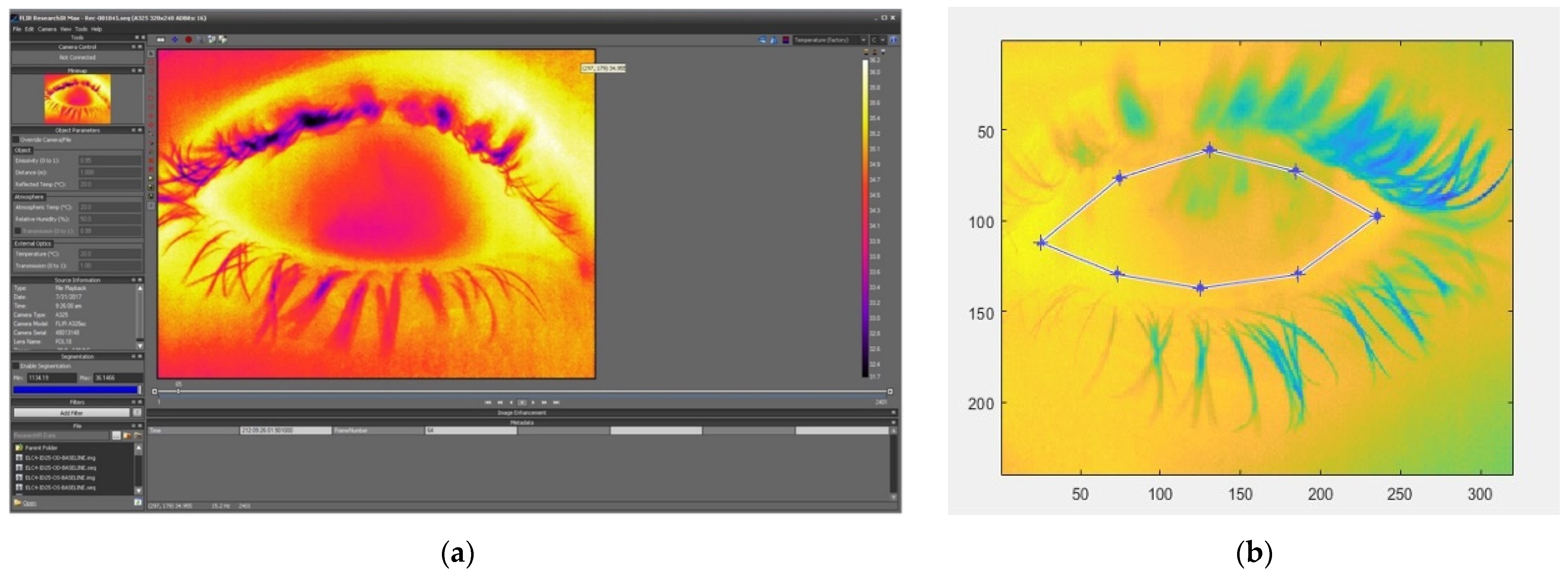 Applied Sciences Free Full Text Ocular Surface Temperature in  