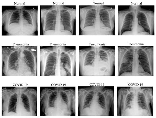 Applied Sciences | Free Full-Text | COVID-19 Chest X-ray