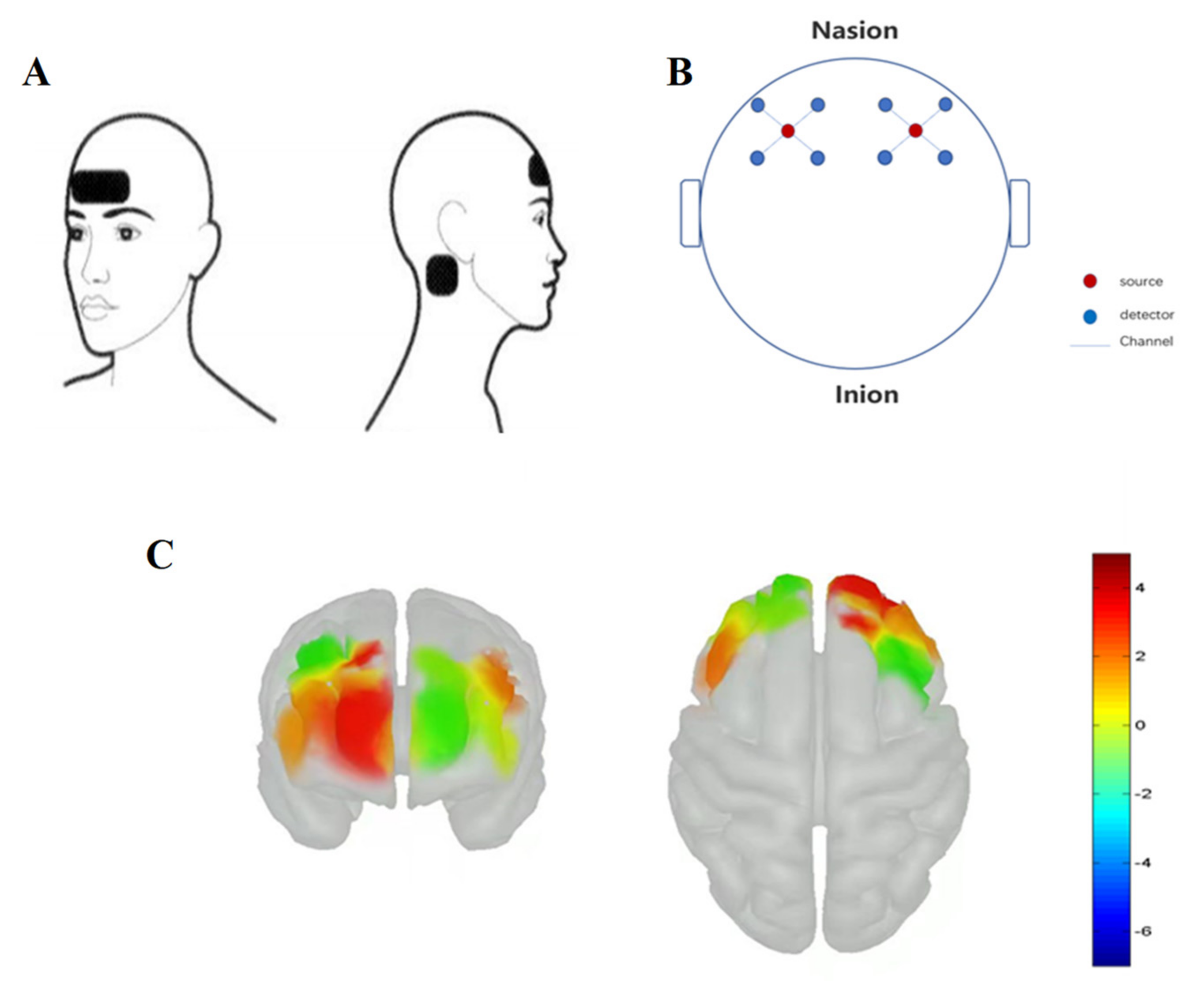 Applsci 12 05609 g001