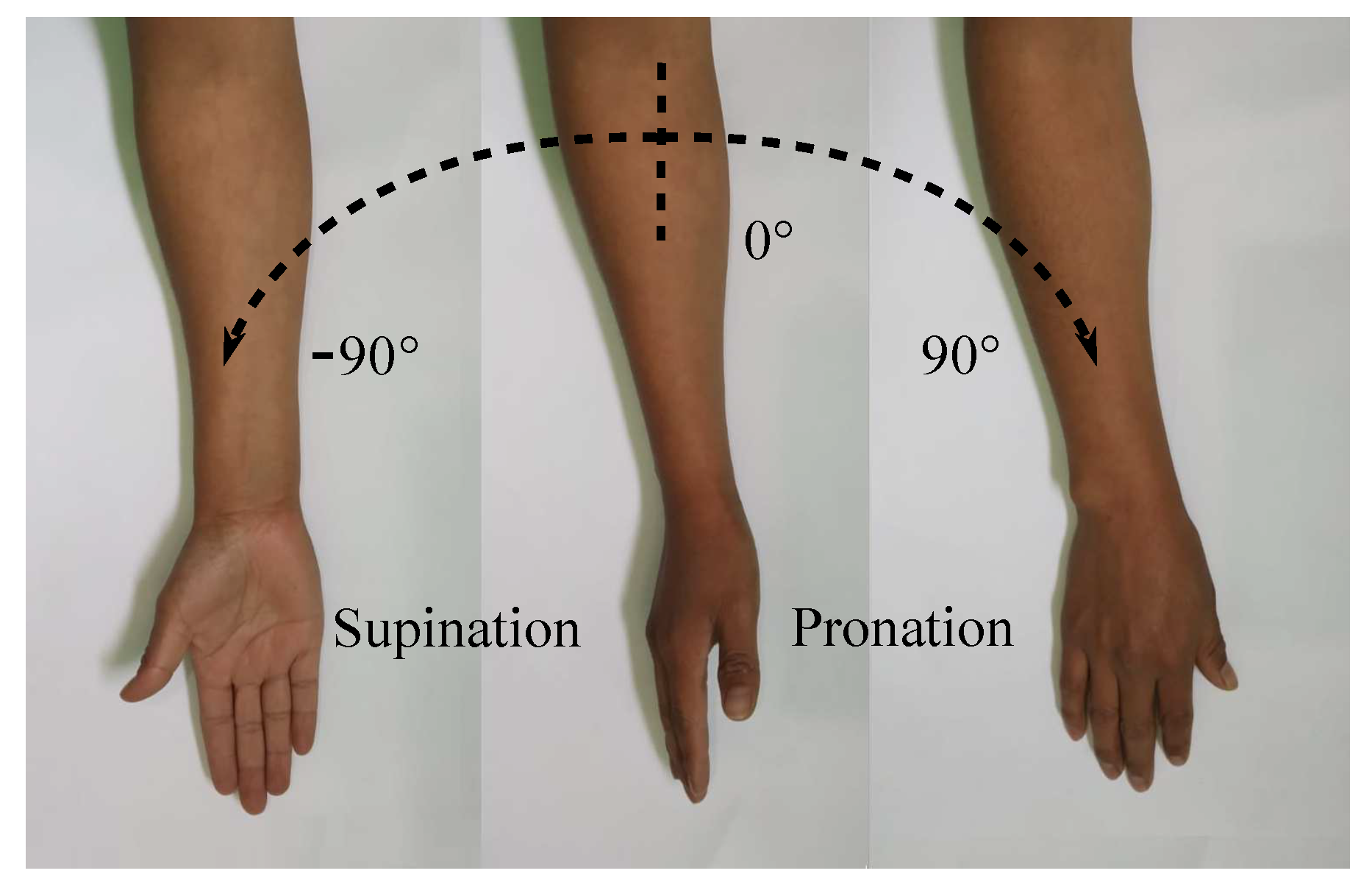 Pronation and Supination of the Forearm. Pronation and Supination