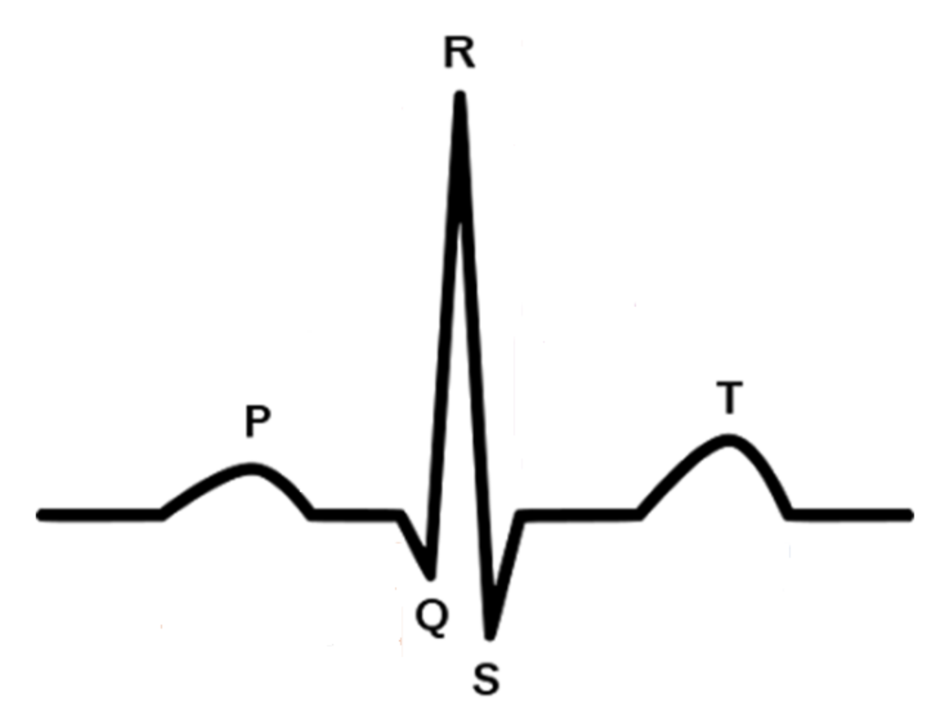 Кардиограмма это. Комплекс PQRST на ЭКГ. Комплекс QRS на ЭКГ норма. Укороченный интервал PQ на ЭКГ. QRST на ЭКГ норма.