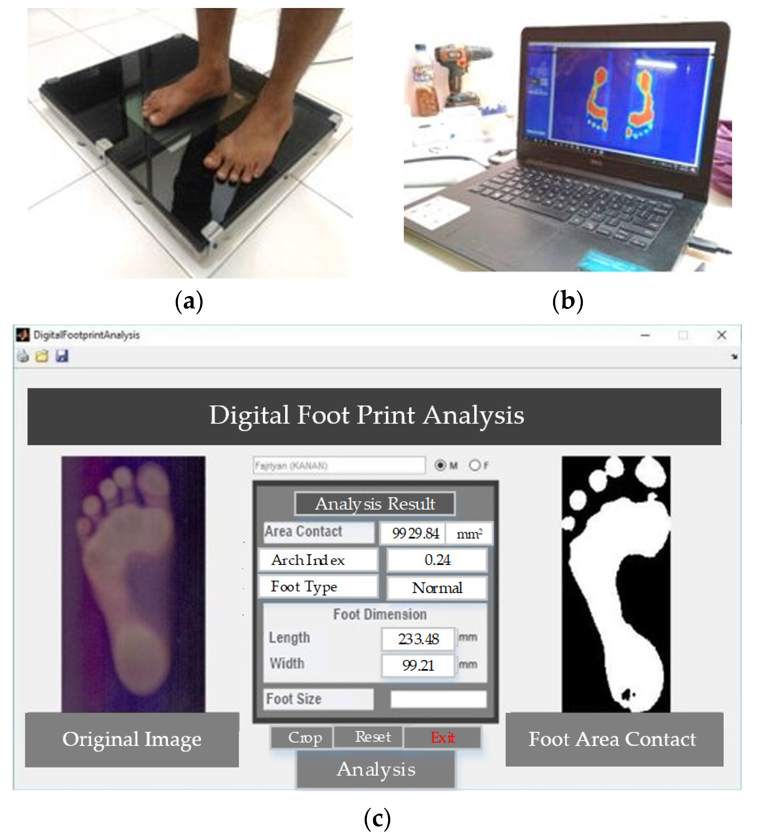 Applied Sciences Free Full Text Calculation of the Rearfoot