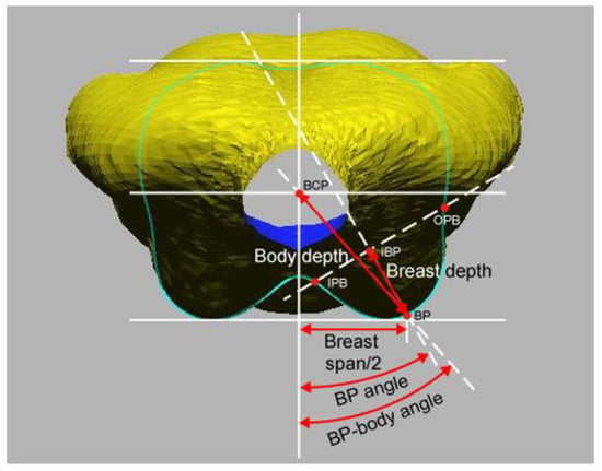 Breast shapes: The diversity of femininity