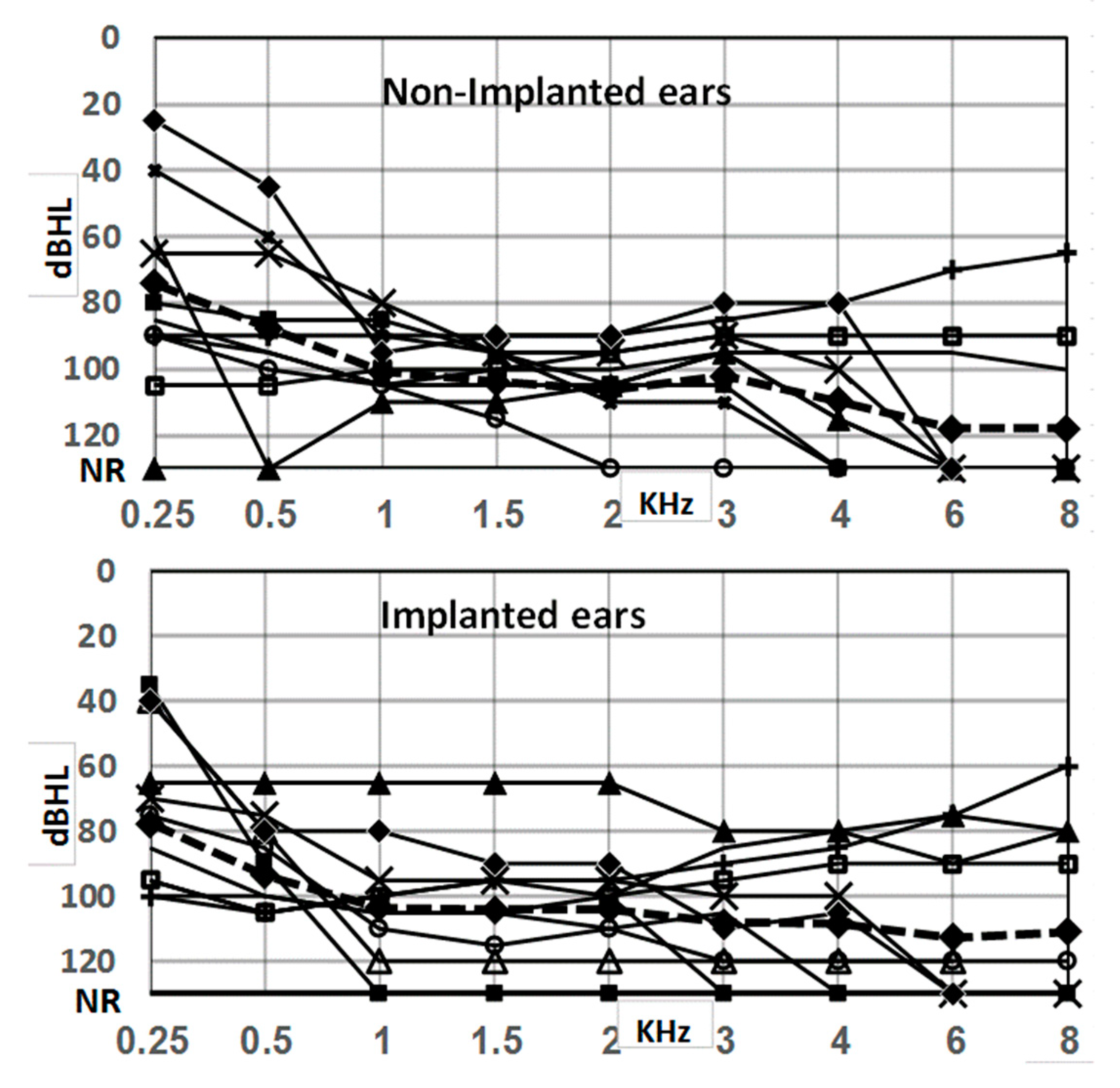Acoustic reflex thresholds for pure tone stimuli (solid line) versus