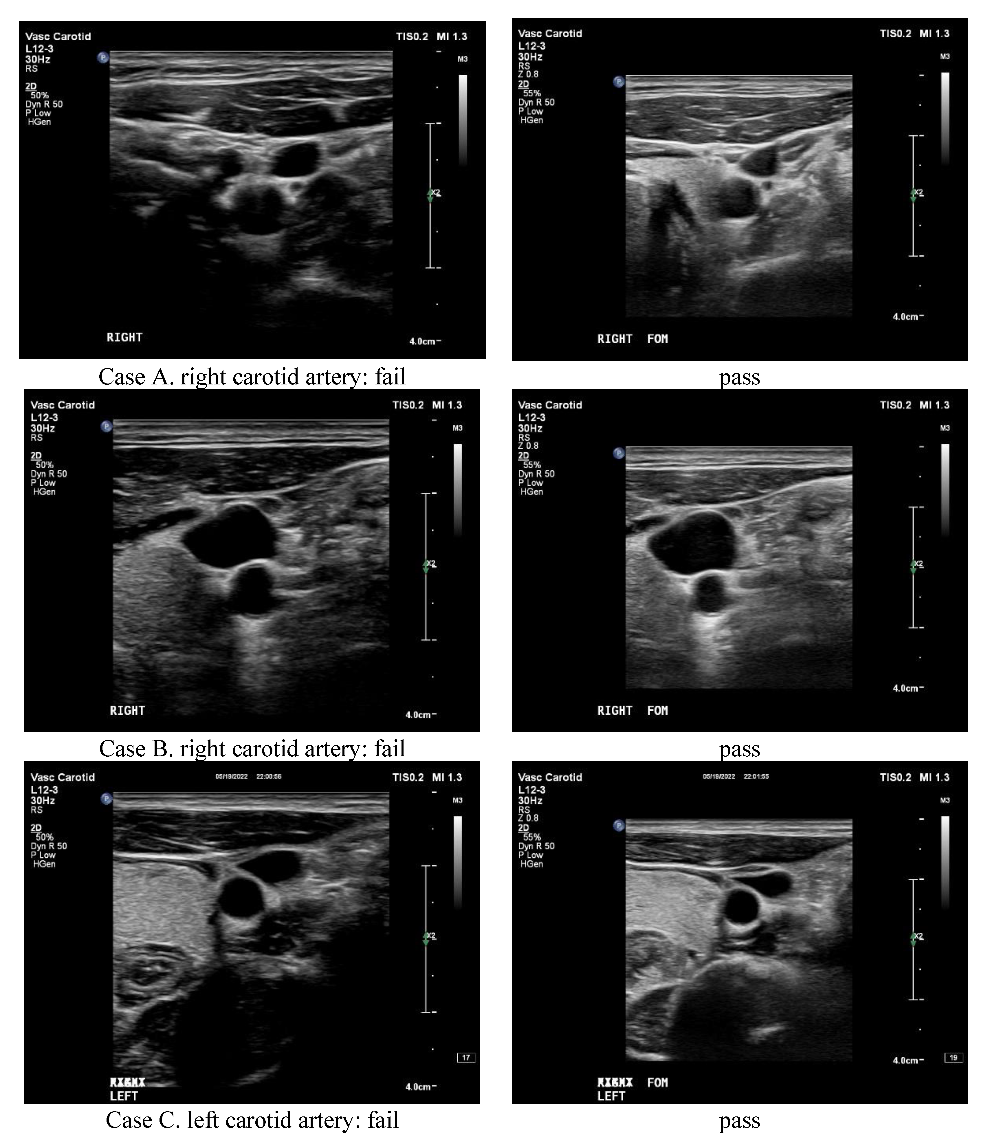 Applsci 12 09751 g005a Applsci 12 09751 g005a