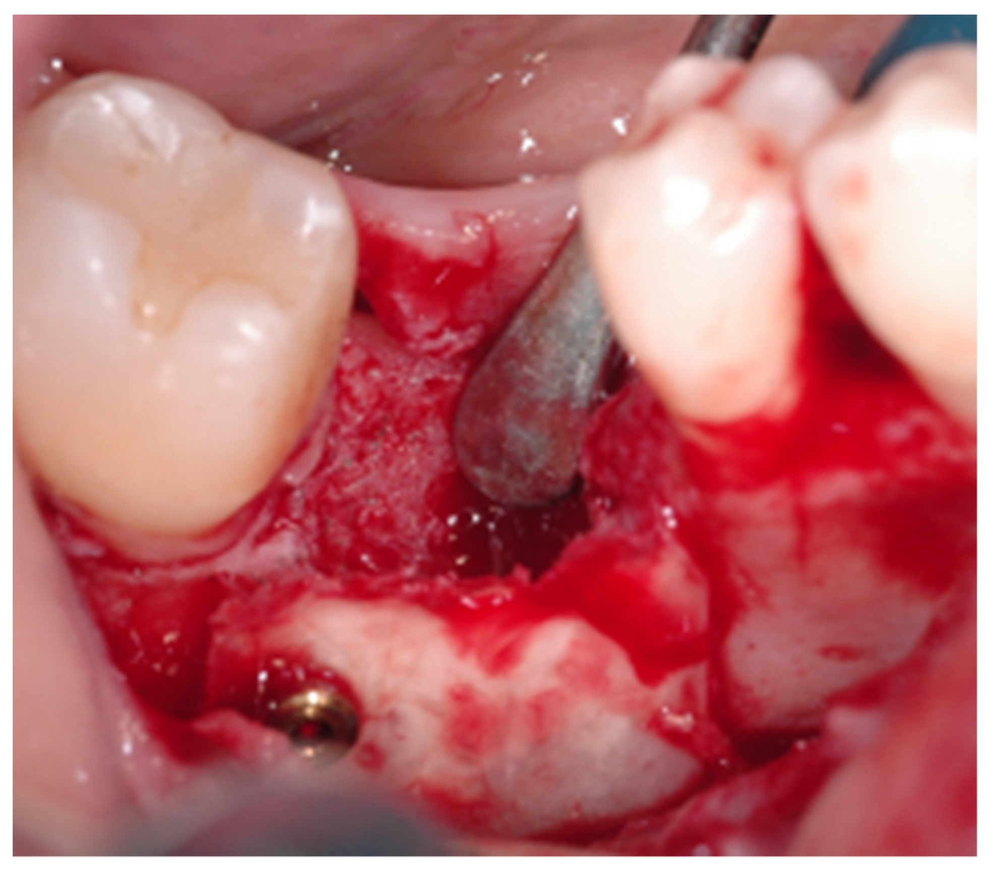 Applsci 12 10285 g002