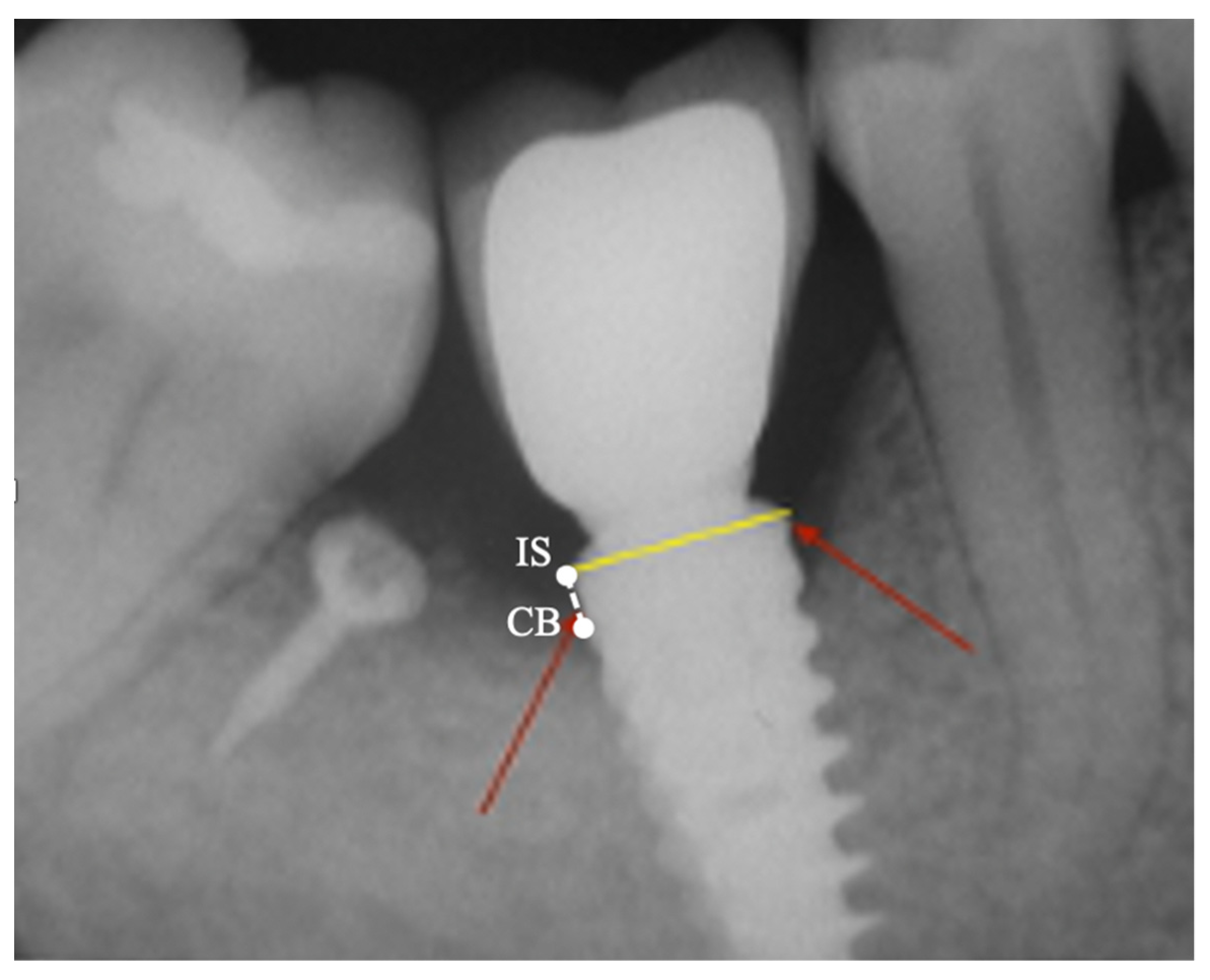 Applsci 12 10285 g005