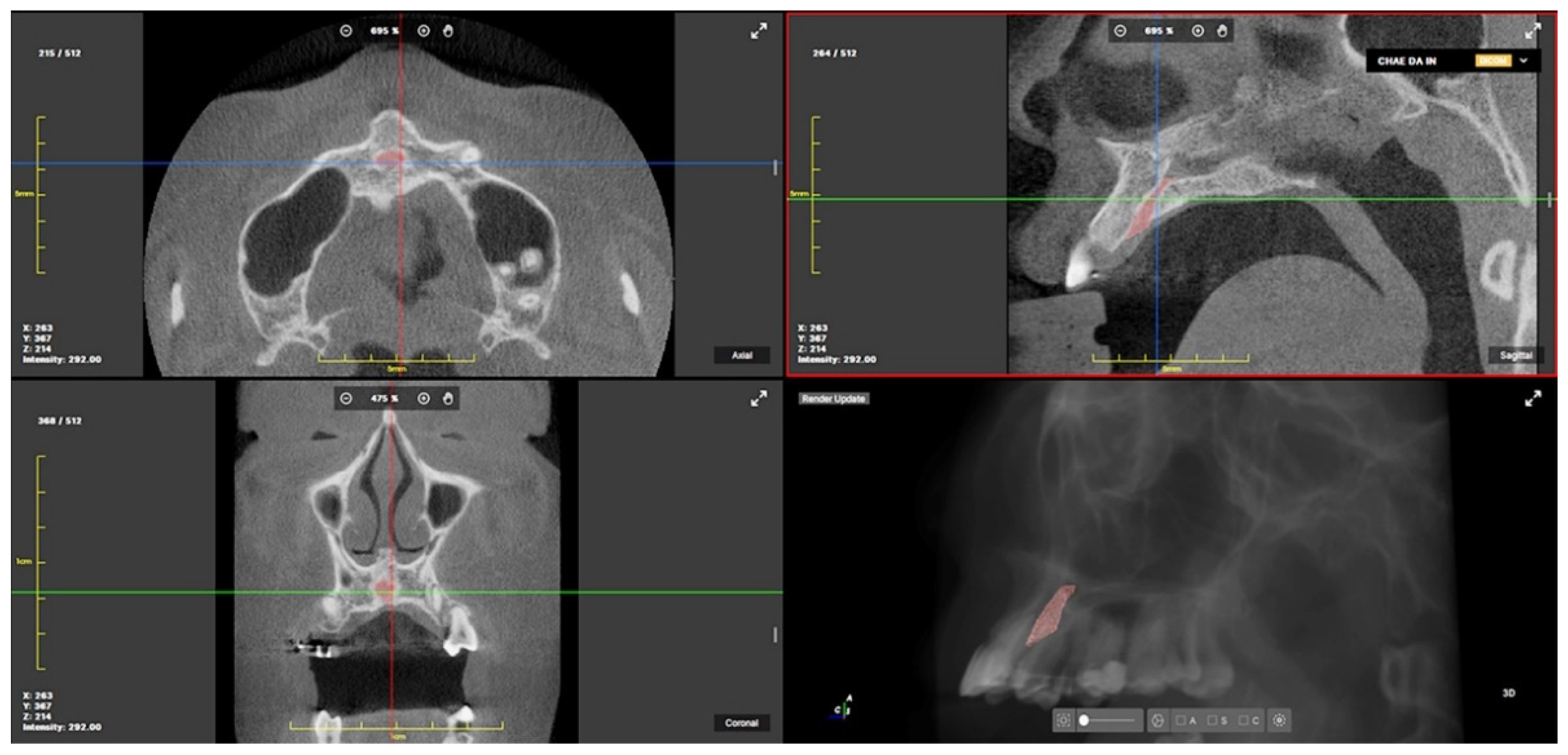 Applsci 12 10470 g004 Applsci 12 10470 g004