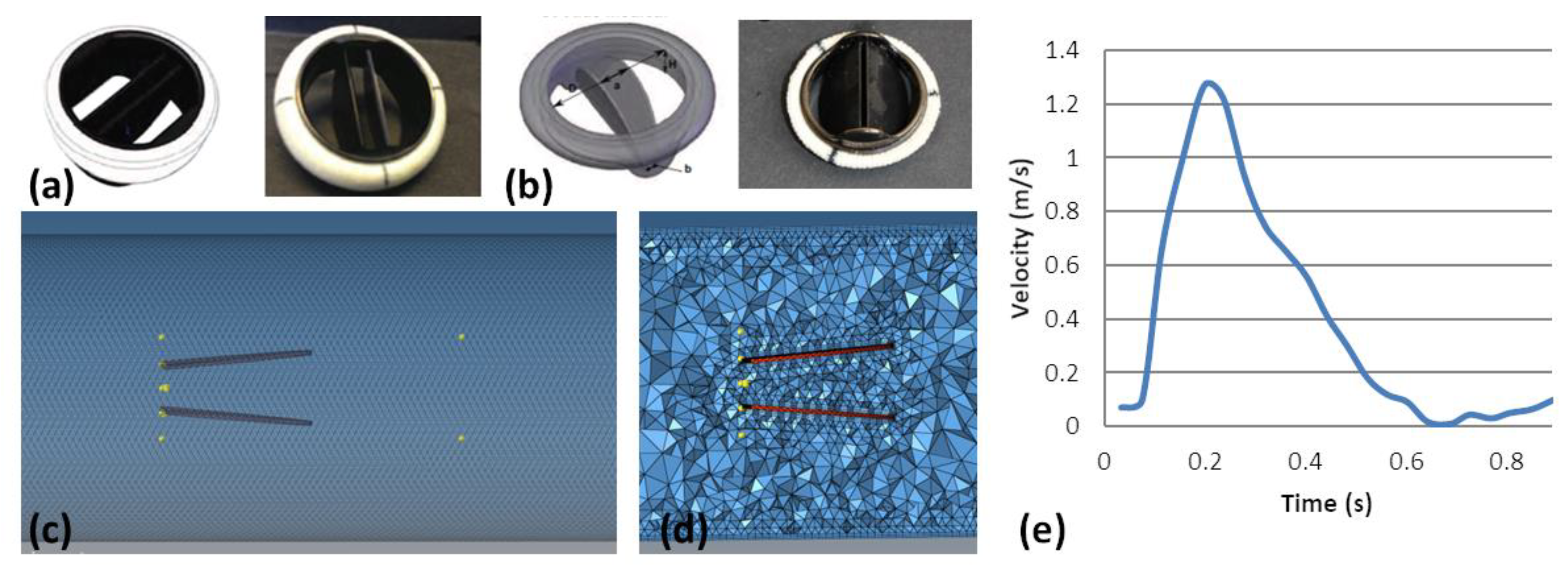 A turbulence in vitro assessment of On-X and St Jude Medical prostheses -  ScienceDirect