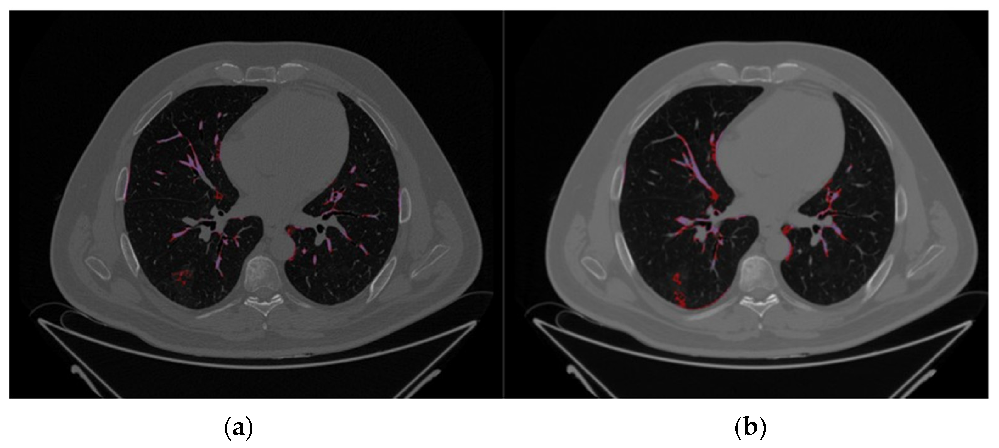 Applsci 12 12065 g002