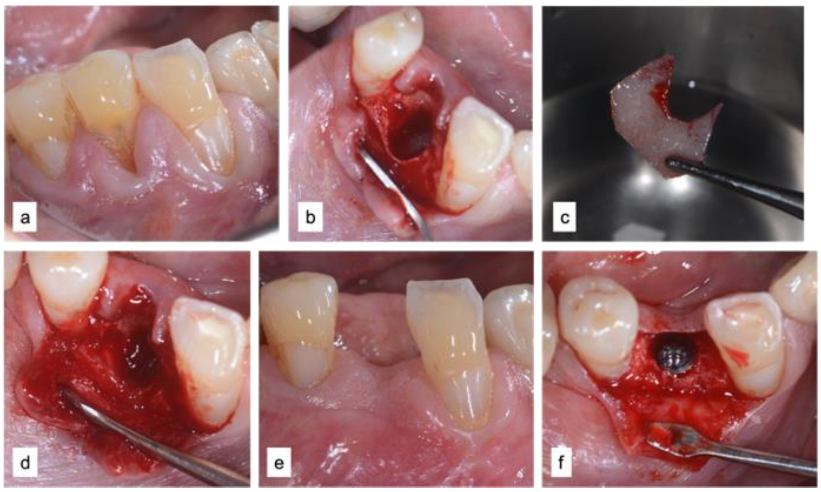 Applsci 12 12292 g003 Applsci 12 12292 g003