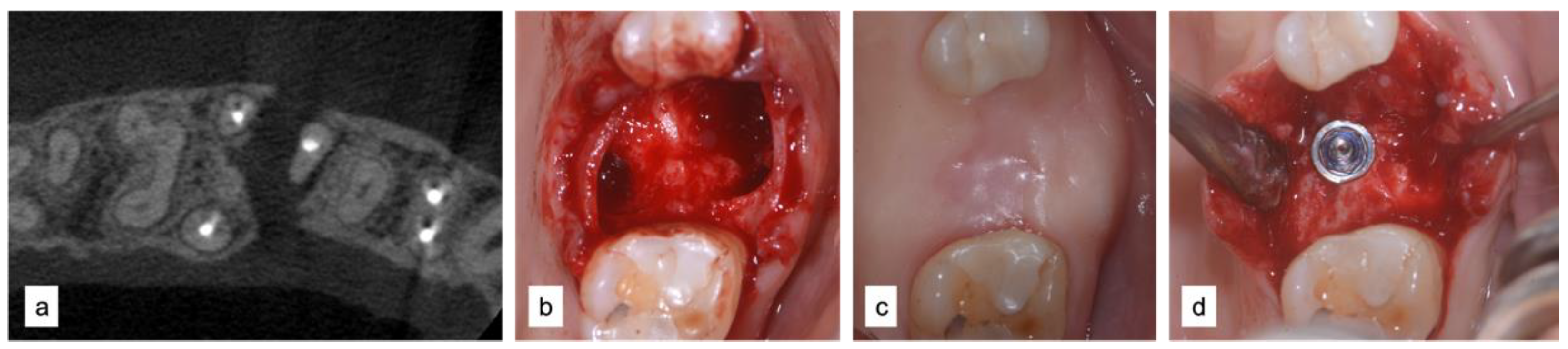 Applsci 12 12292 g004 Applsci 12 12292 g004