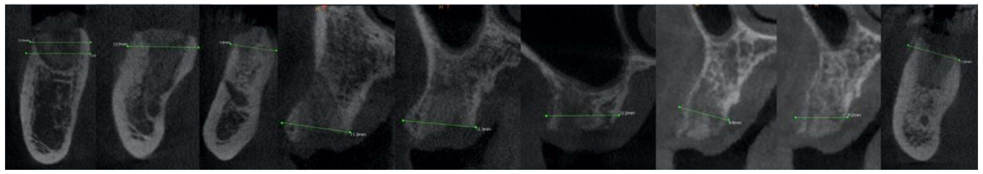 Applsci 12 12292 g006 Applsci 12 12292 g006