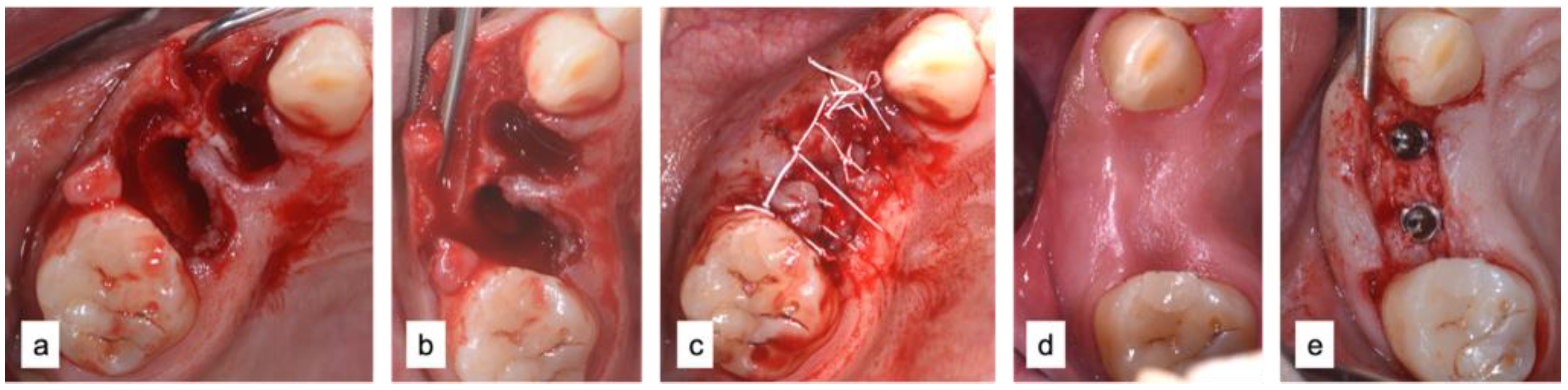 Applsci 12 12292 g007 Applsci 12 12292 g007