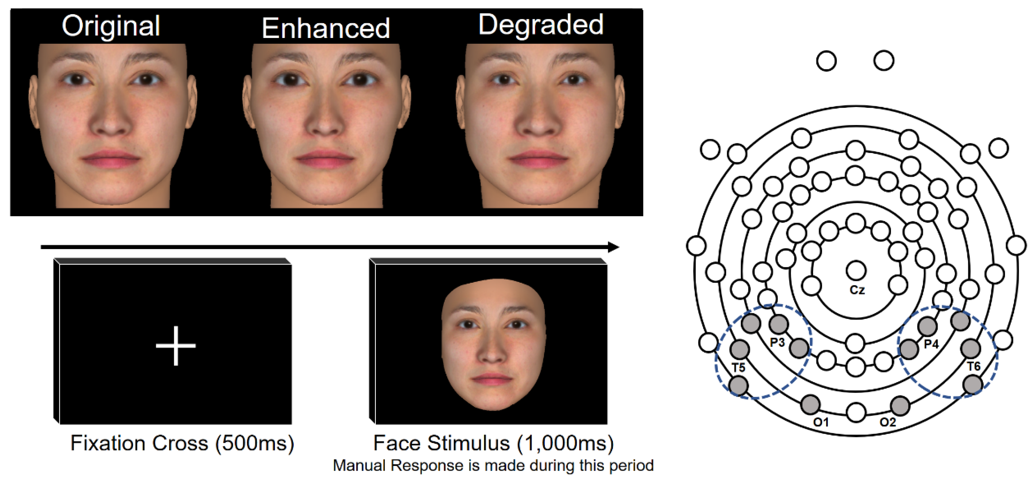 Applied Sciences | Free Full-Text | Multivariate ERP Analysis of Neural  Activations Underlying Processing of Aesthetically Manipulated Self-Face