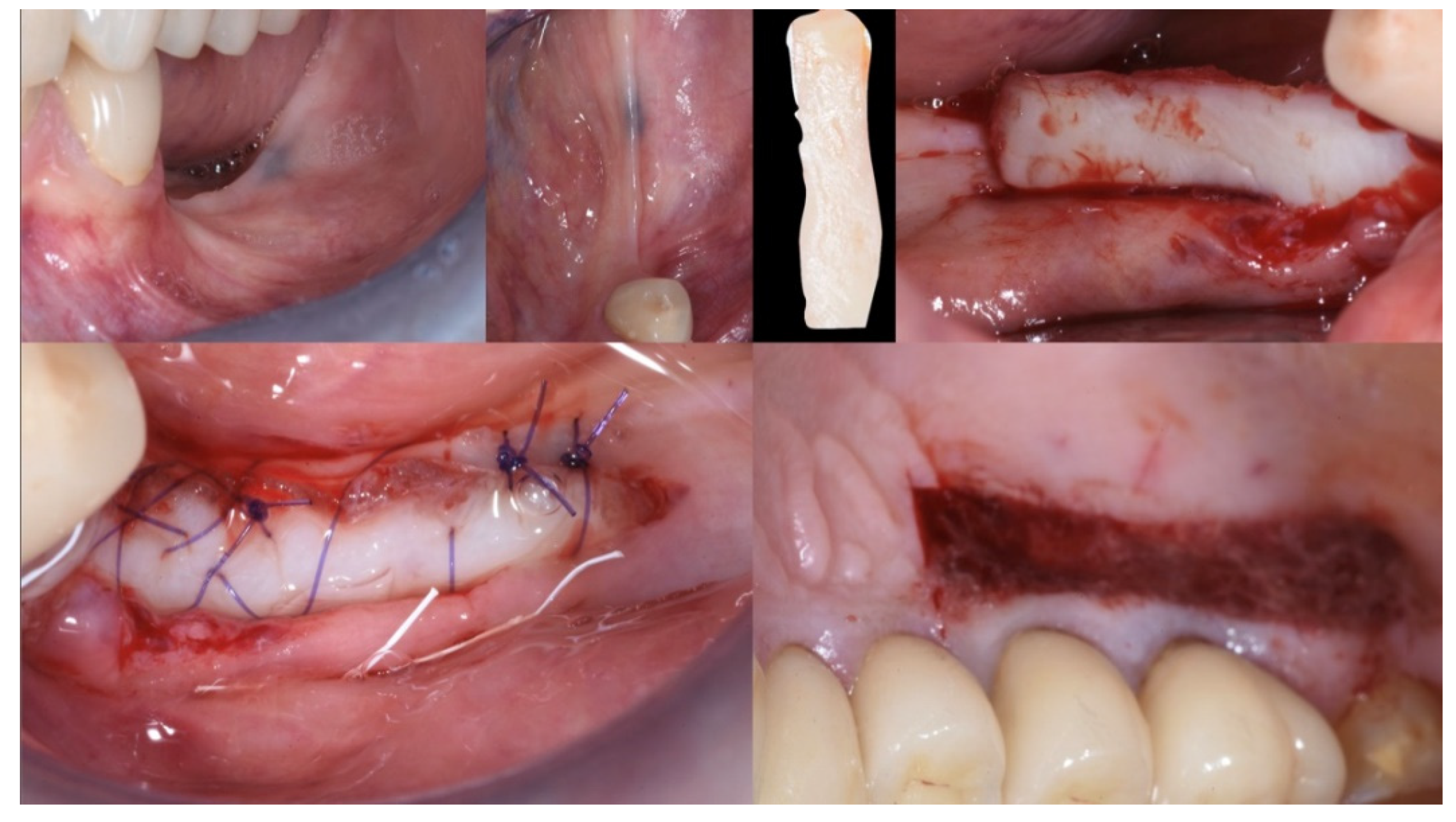 Applsci 13 00692 g004 Applsci 13 00692 g004