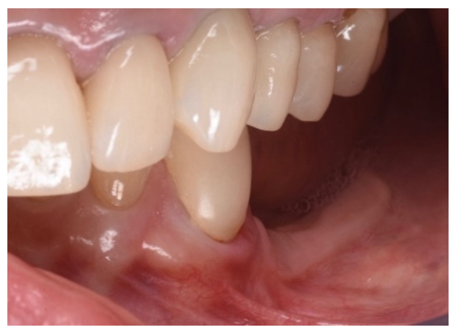 Applsci 13 00692 g005 Applsci 13 00692 g005