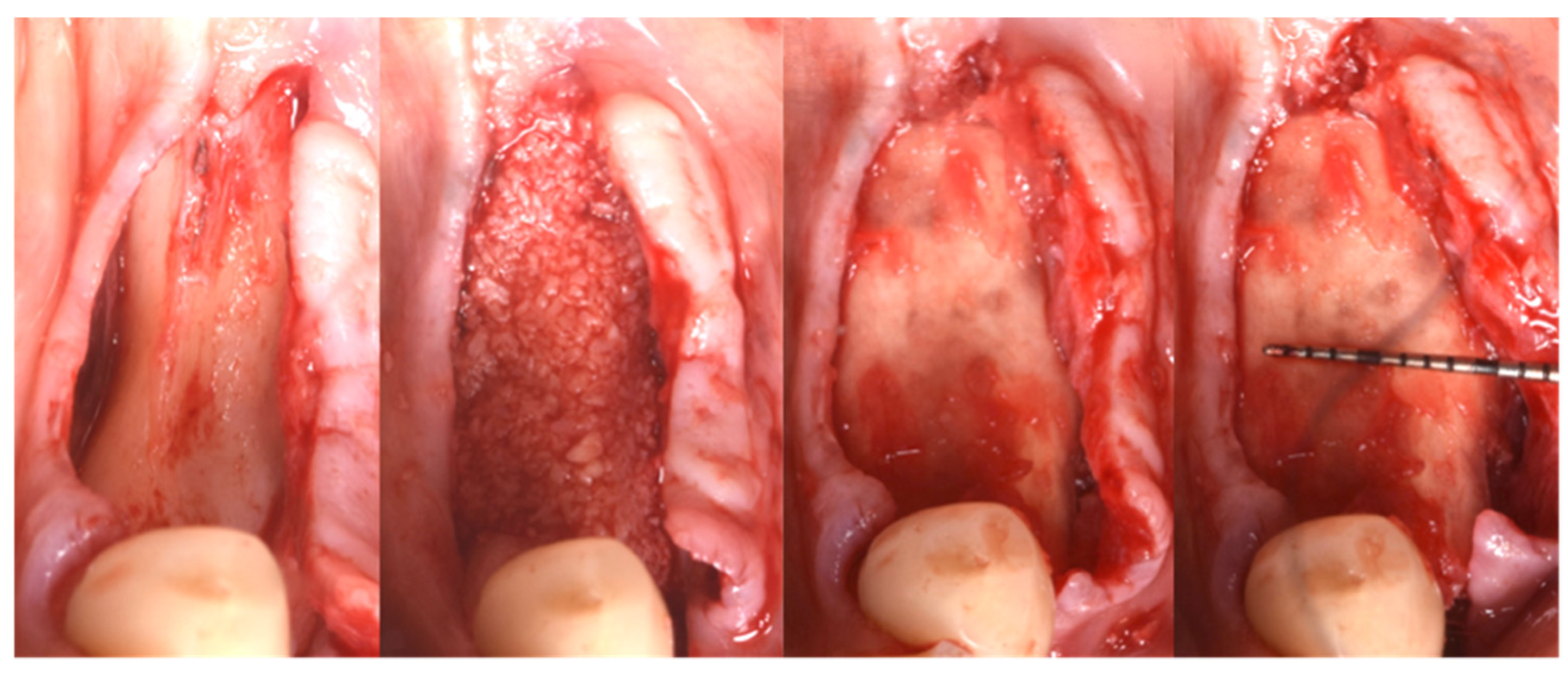 Applsci 13 00692 g006 Applsci 13 00692 g006