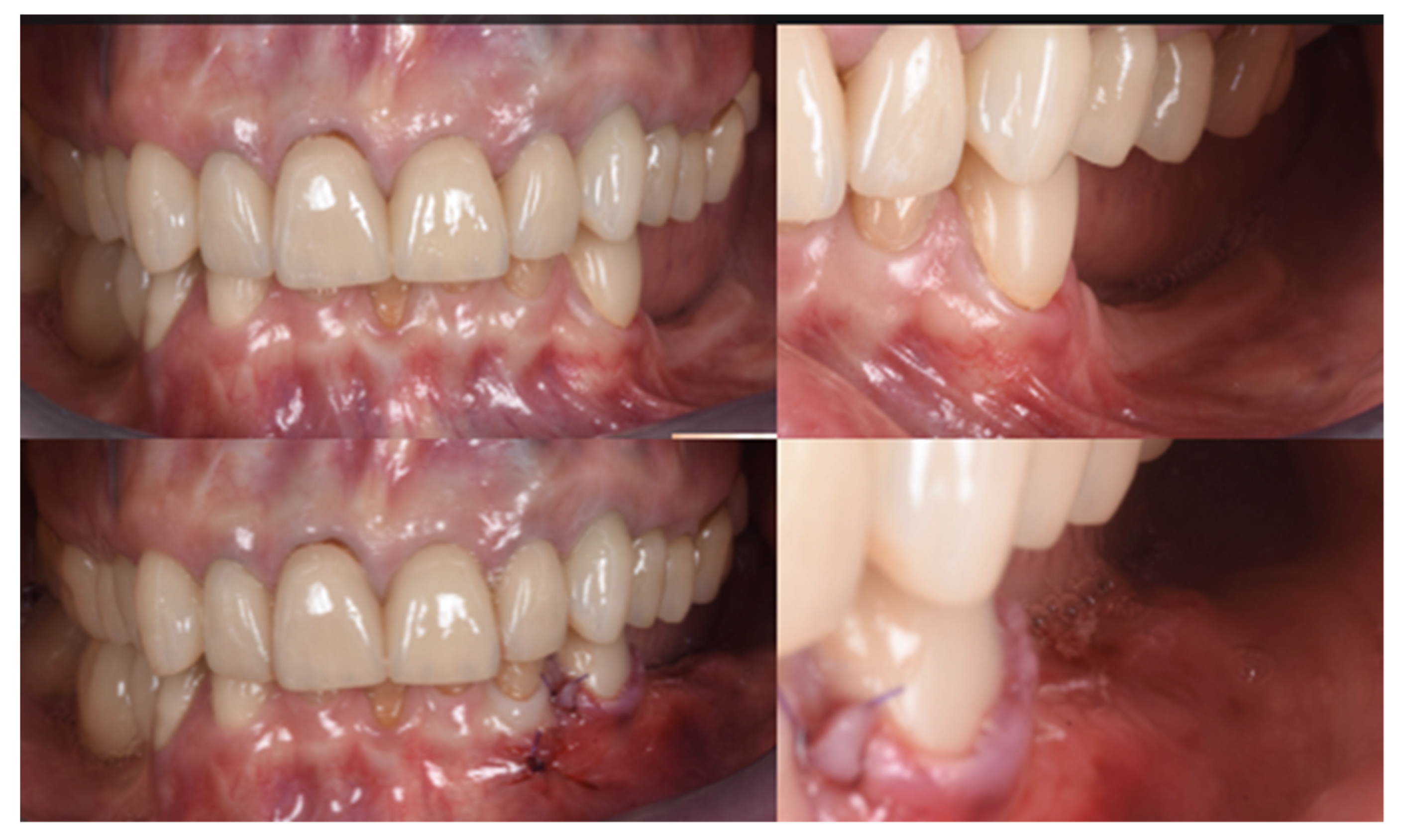 Applsci 13 00692 g007 Applsci 13 00692 g007