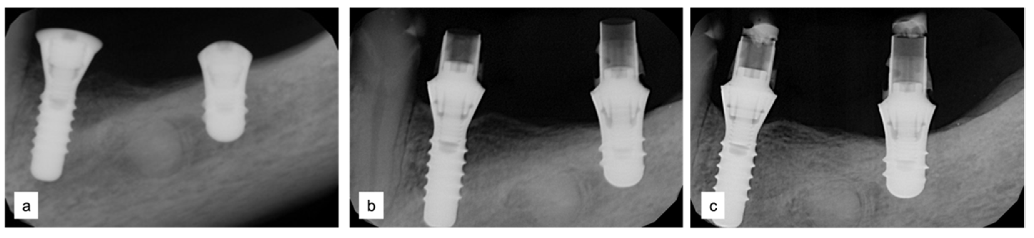 Applsci 13 00692 g009 Applsci 13 00692 g009