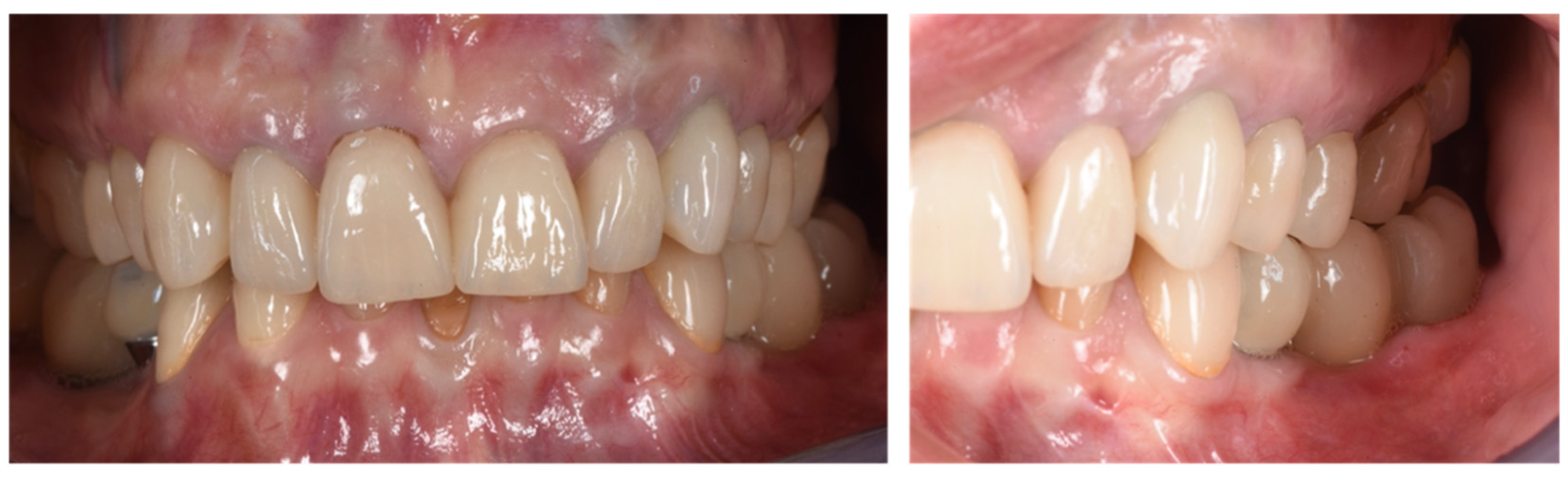 Applsci 13 00692 g010 Applsci 13 00692 g010