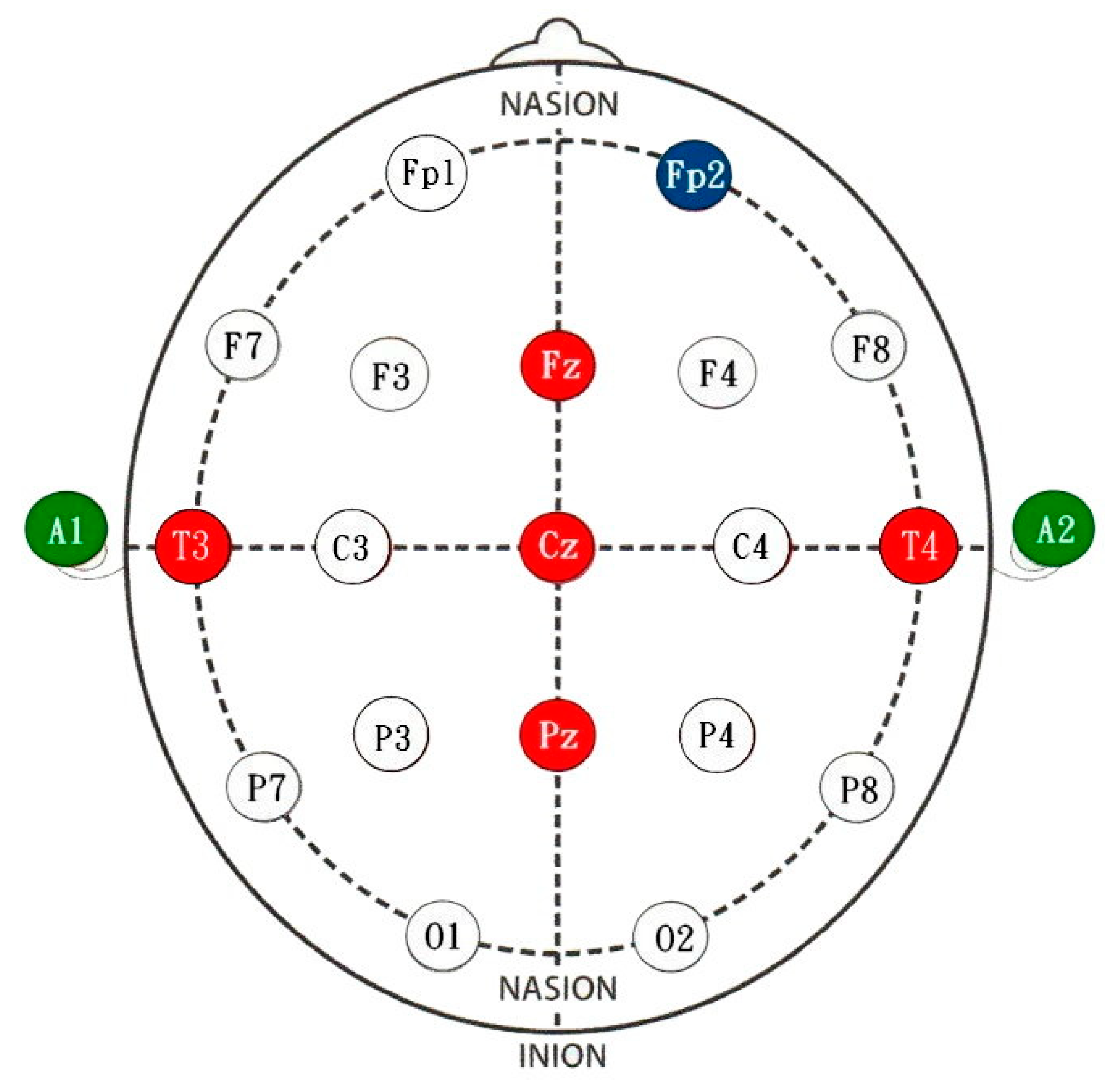 Applsci 13 00856 g005 Applsci 13 00856 g005