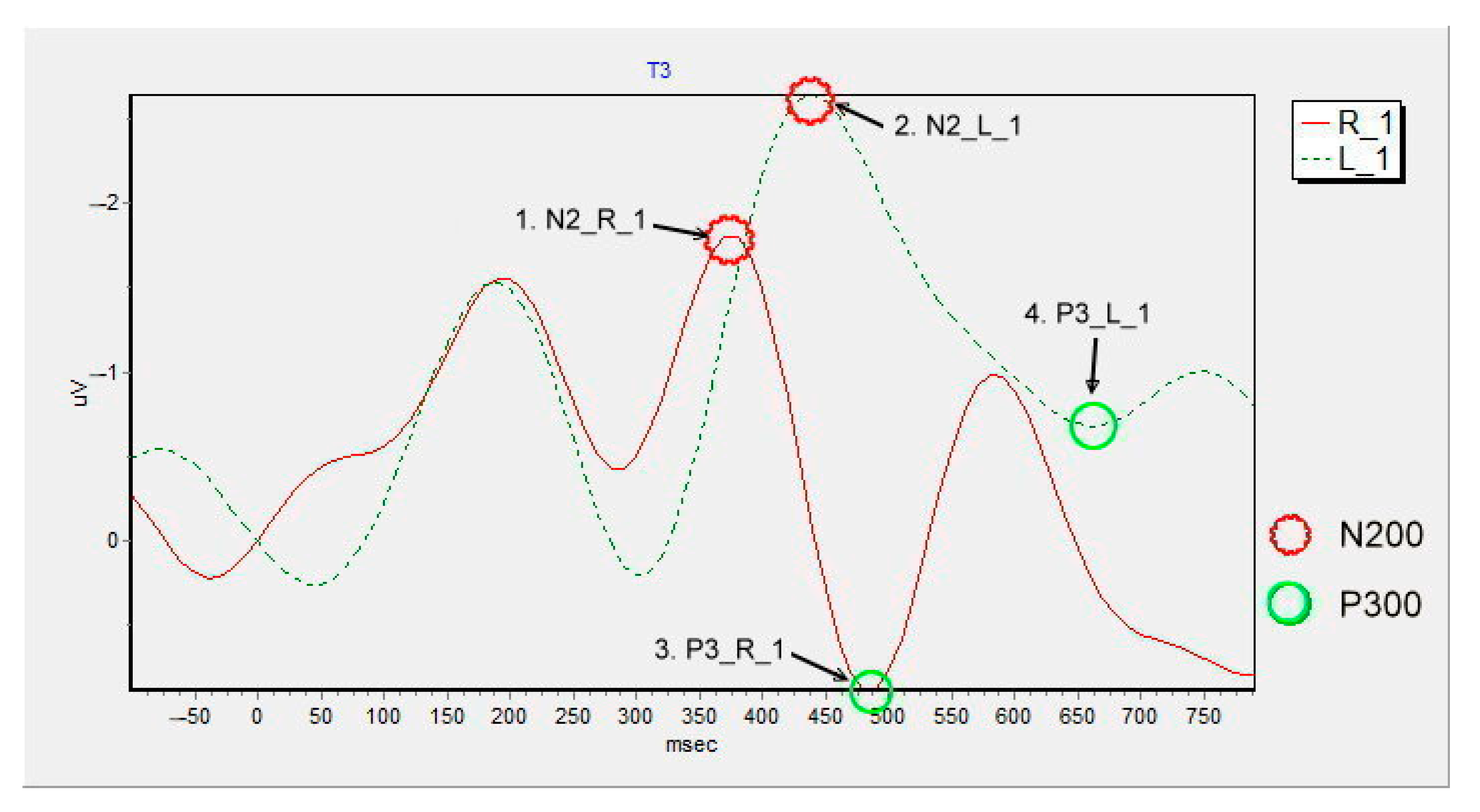 Applsci 13 00856 g010 Applsci 13 00856 g010