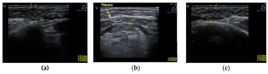 2019 Scientific Program - 2019 - Journal of Ultrasound in Medicine