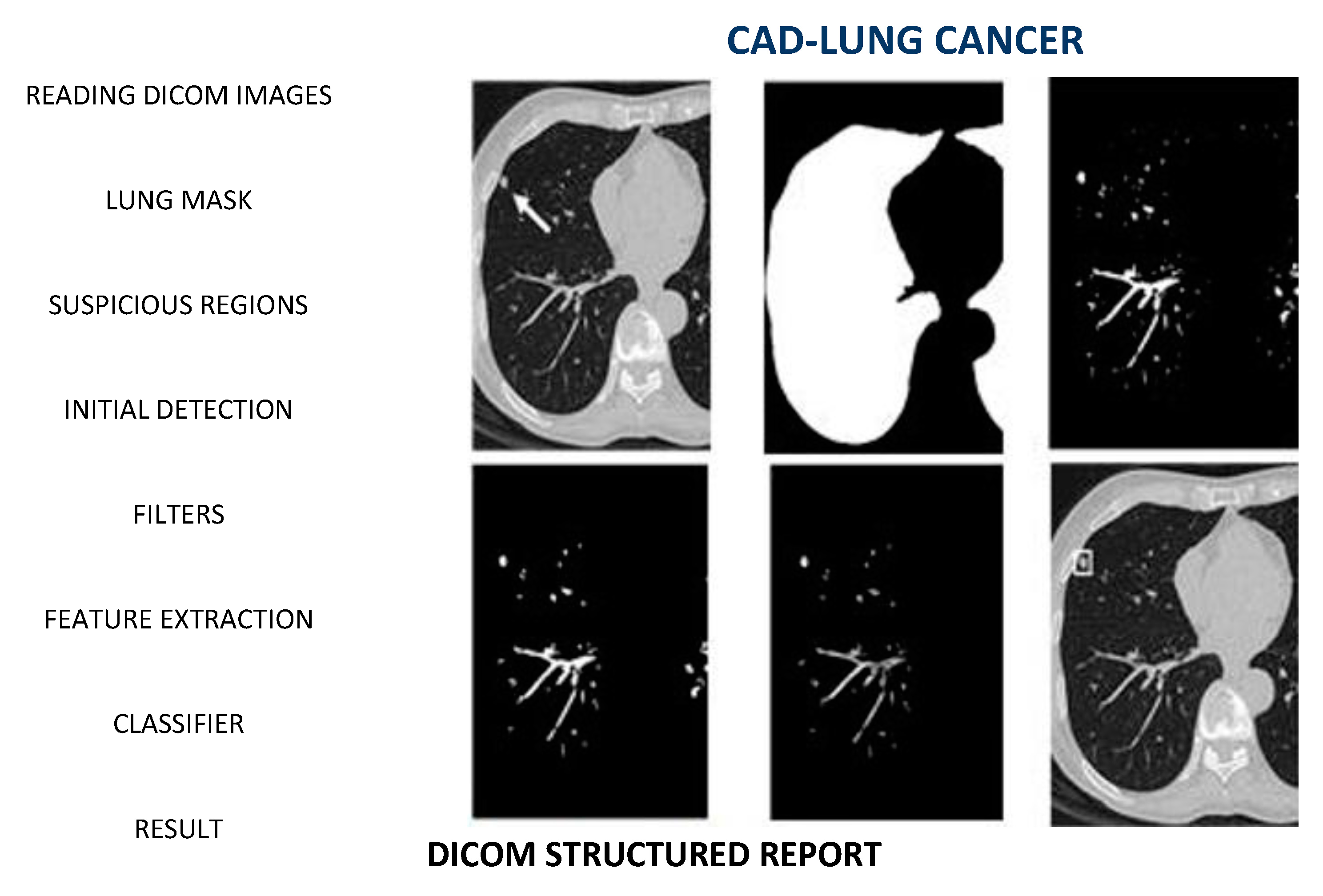 Applied Sciences | Free Full-Text | Digital Medical X-ray Imaging, CAD in  Lung Cancer and Radiomics in Colorectal Cancer: Past, Present and Future