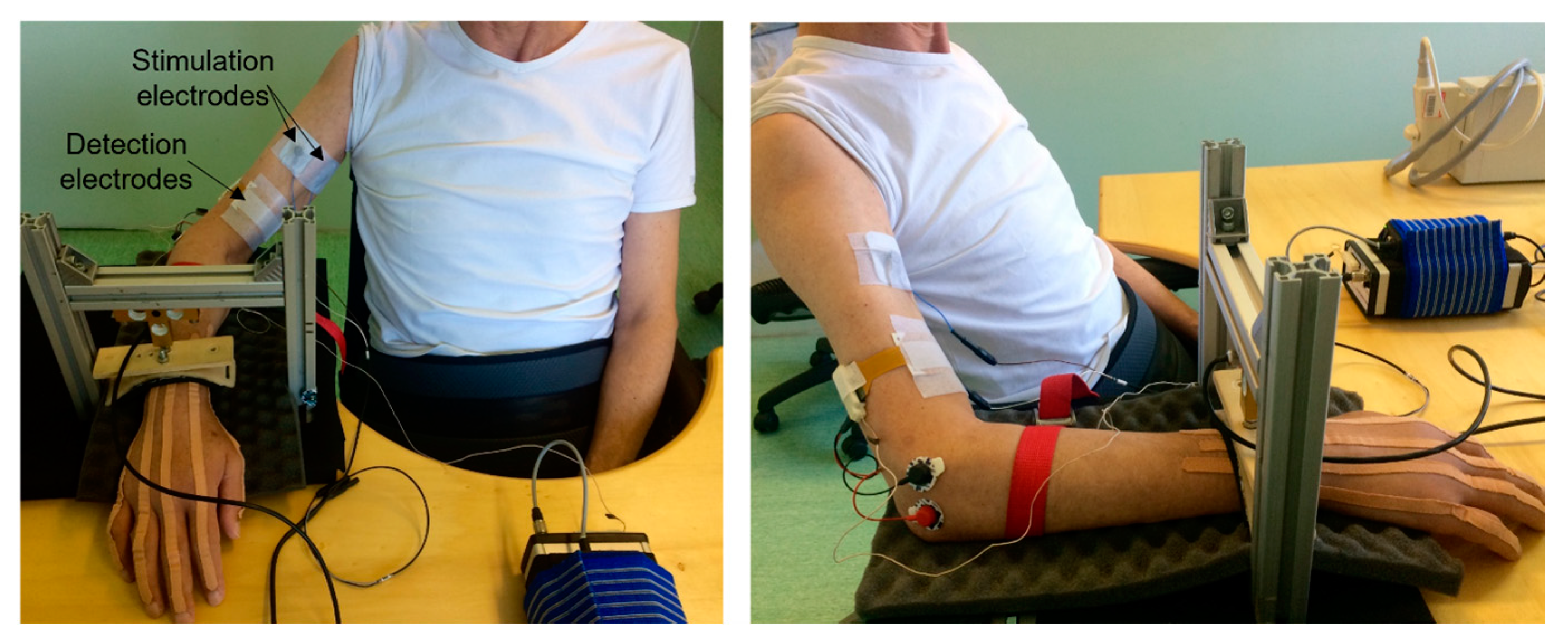 Surface electrodes positioned to apply neuromuscular electrical