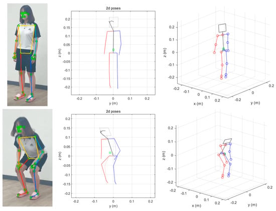 Master MediaPipe Pose Estimation (RealTime) | Advanced Course for Accurate Human  Pose Tracking