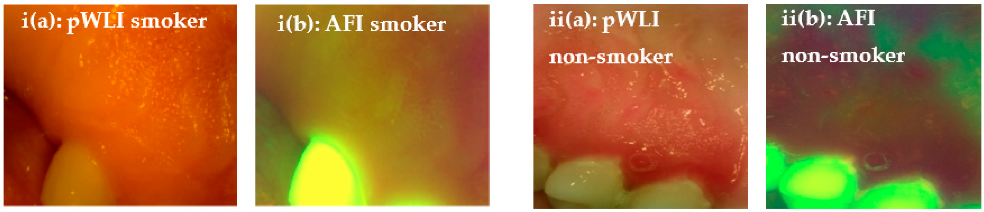 Applsci 13 03370 g005