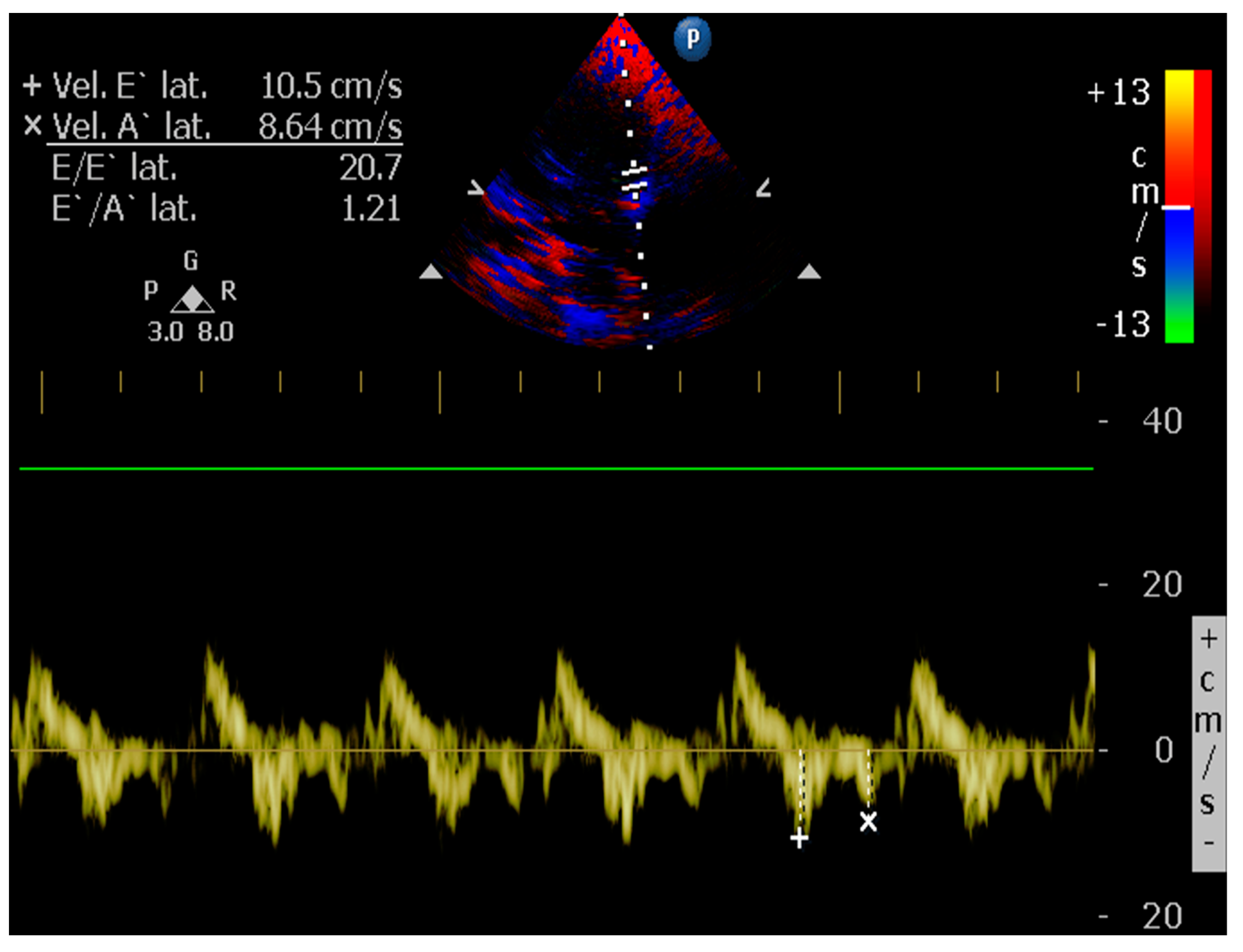 A Clinician's Guide to Tissue Doppler Imaging