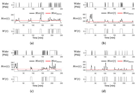 Polysomnography - Wikipedia